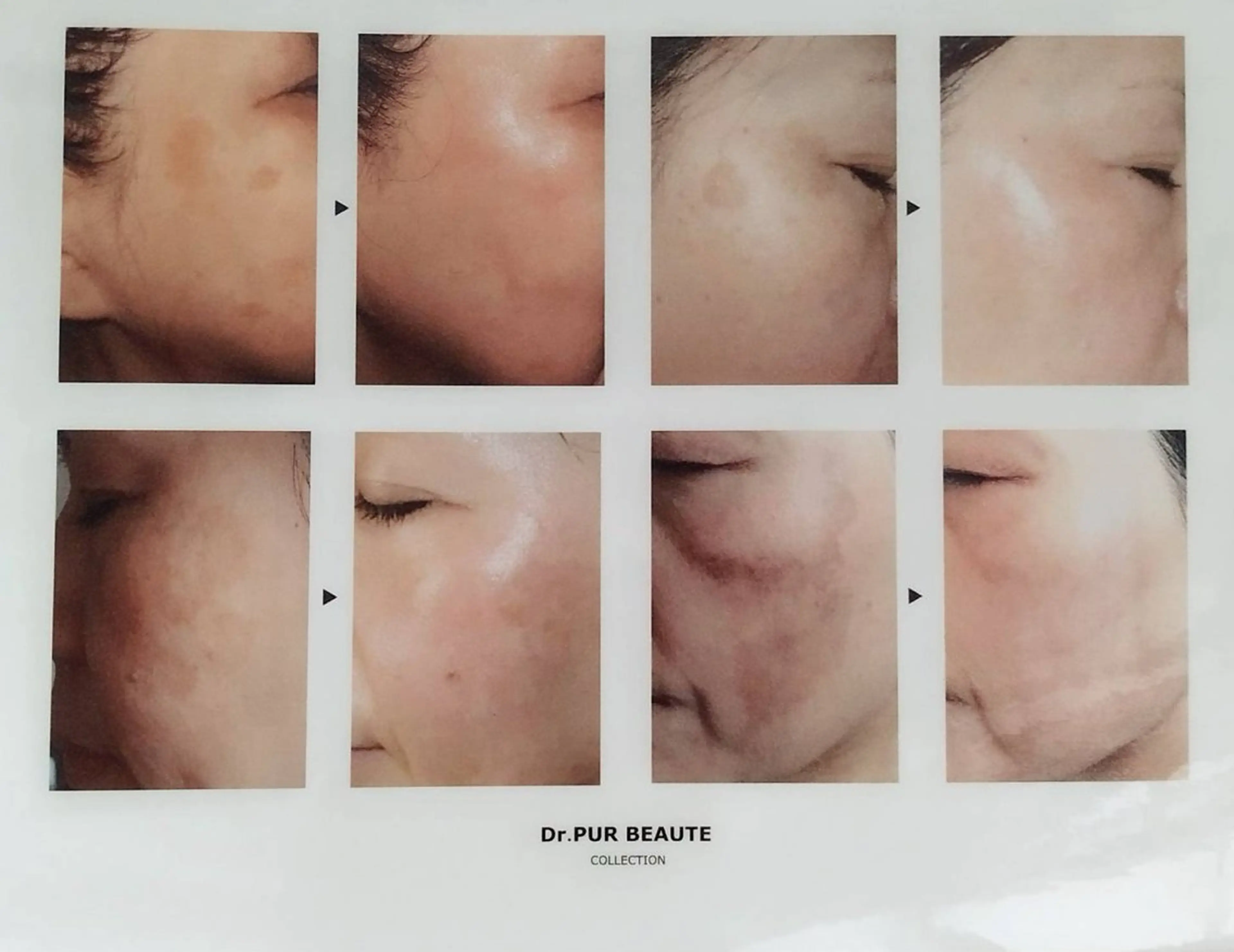 ハーブピーリング　美肌サロン　health and beauty maki所属・ハーブピーリング 美肌サロン　makiのエステ・リラクイメージ