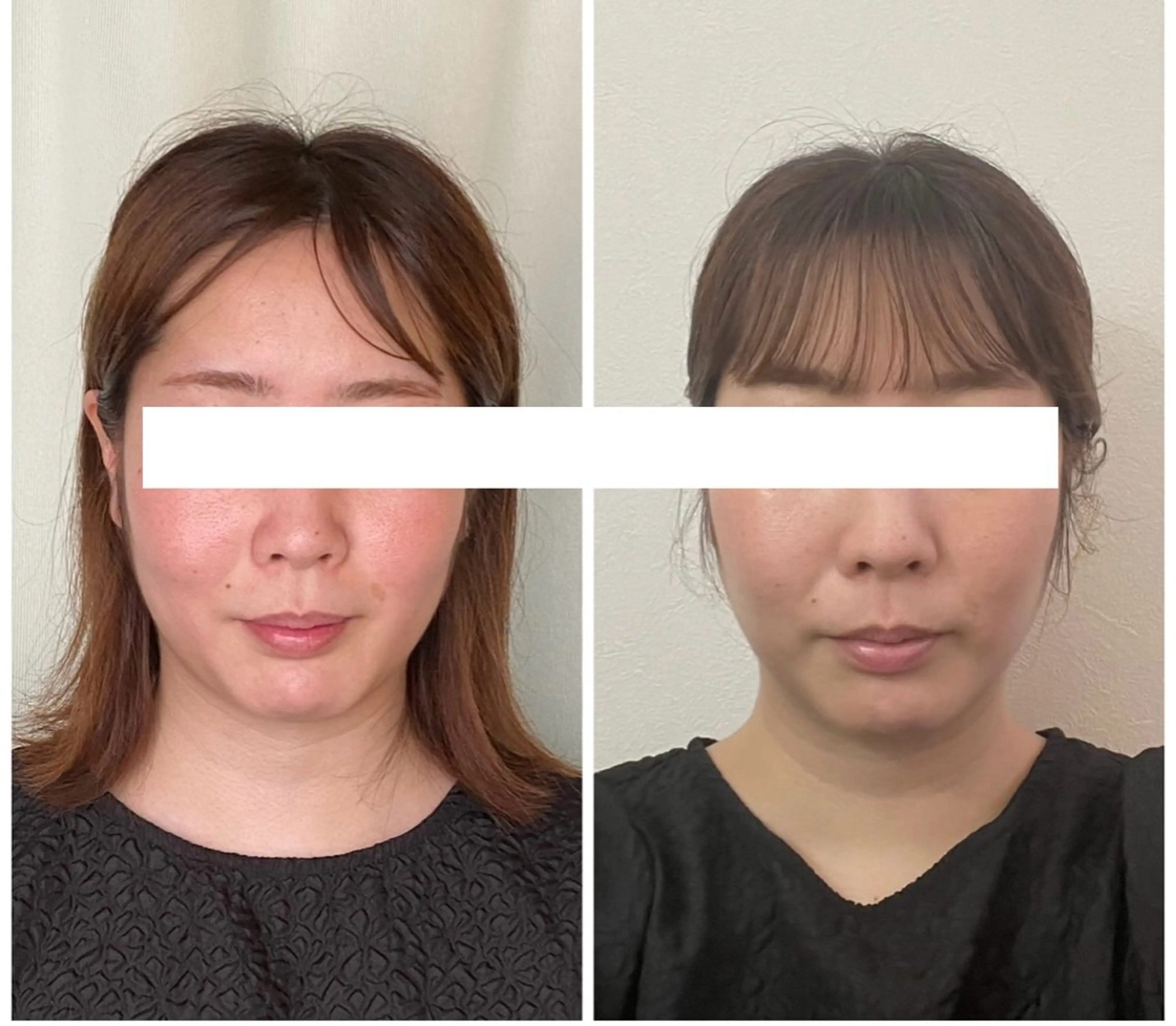 丸顔さんの救世主 高田 くみのエステ・リラクイメージ