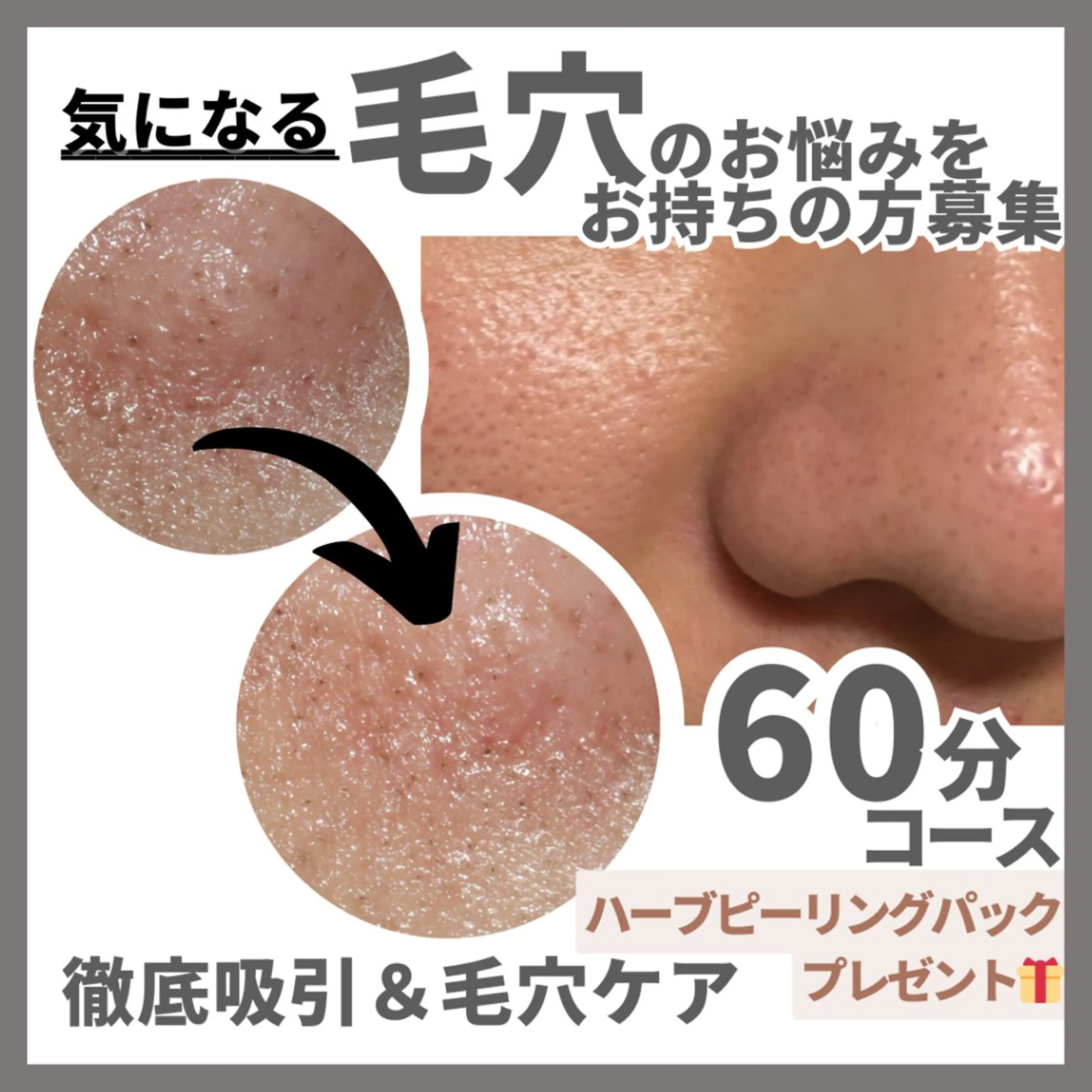 【毛穴悩みさん🉐 1月受付5名迄】毛穴集中コースエステに只今ハーブピーリングパック🌿をプレゼントでお付けしておりますの写真