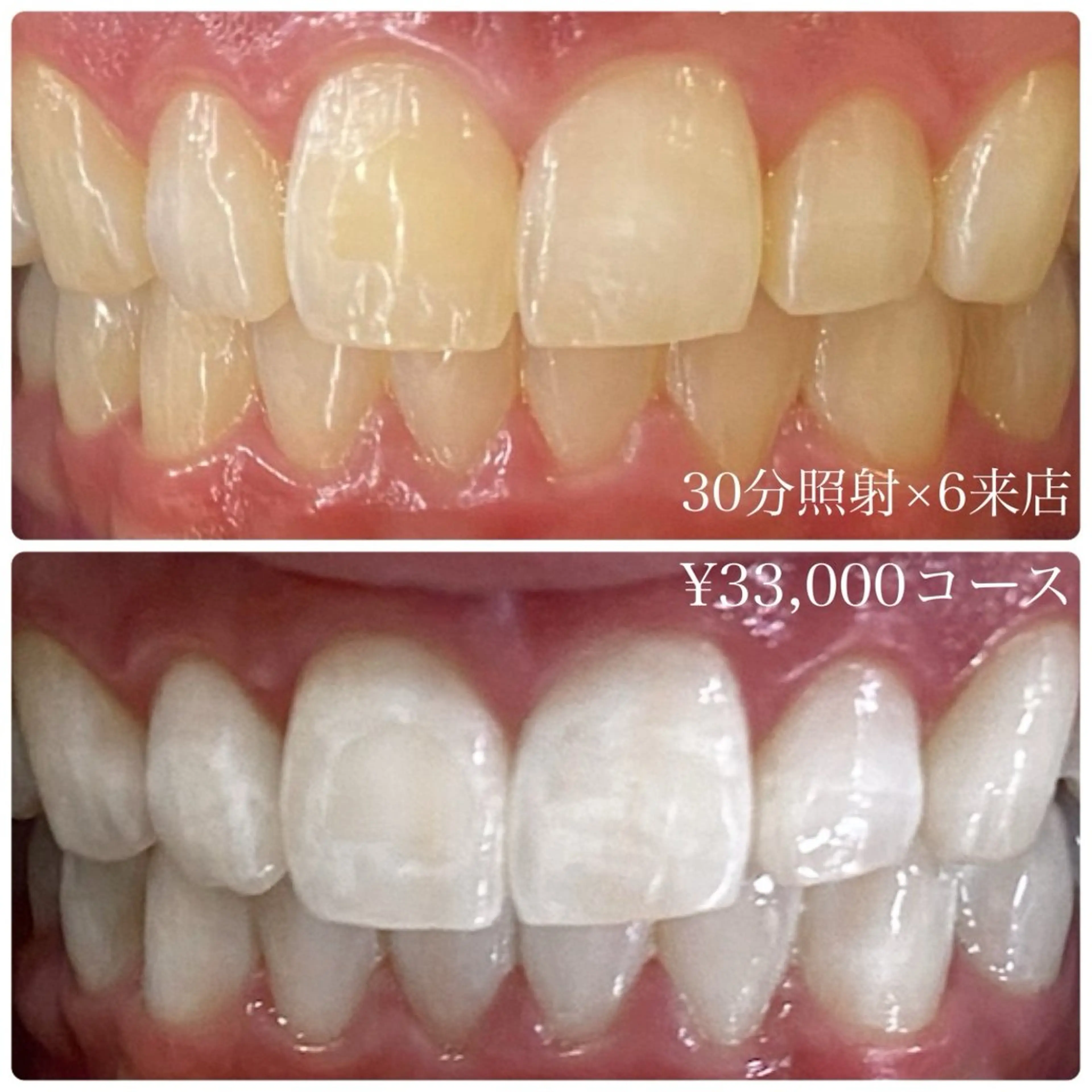 その他 PLATINUM Beauty 横浜店所属・ホワイトニングルーム 横浜店のその他イメージ