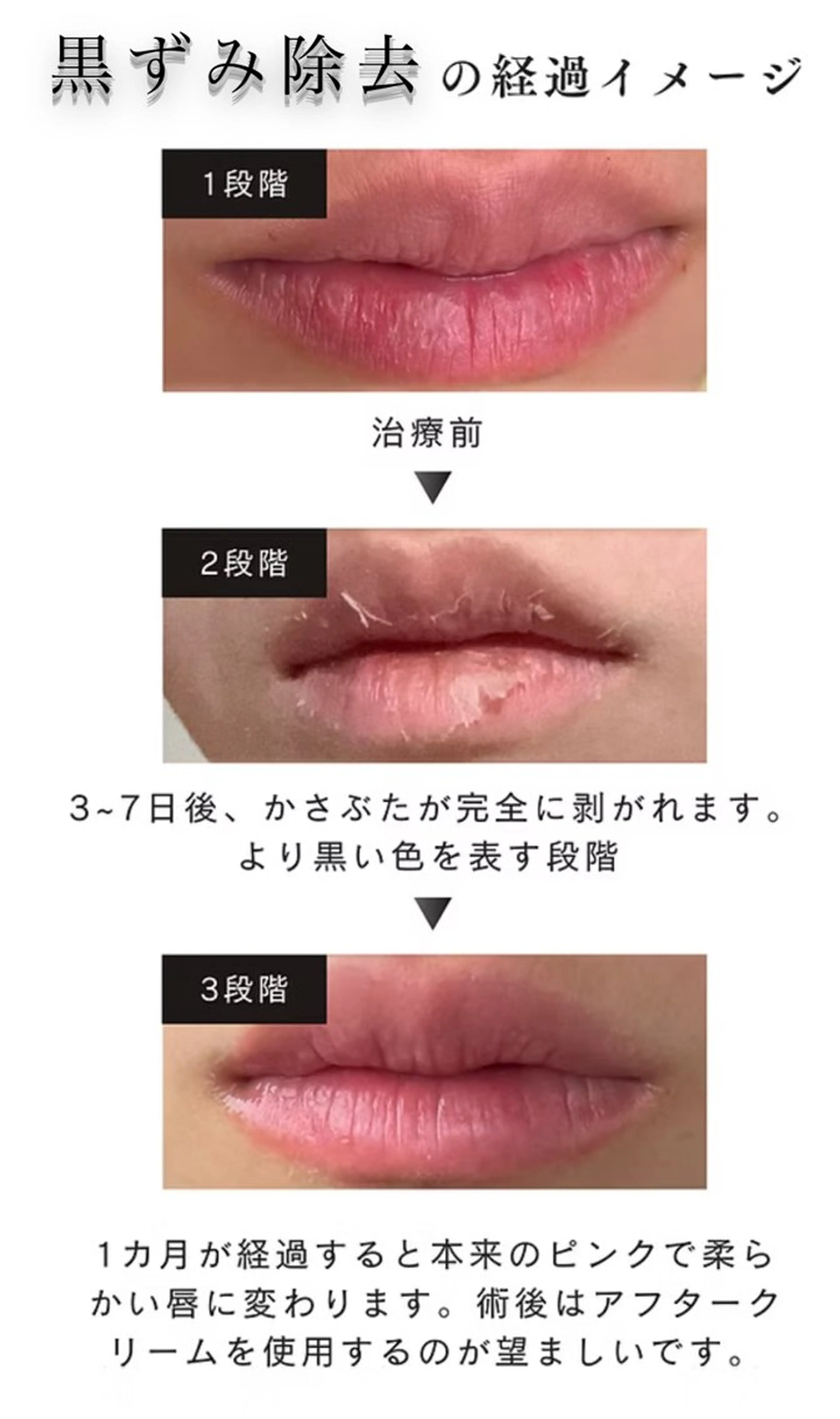 本気で痩せたい方へ 痩身専門サロンのエステ・リラクイメージ