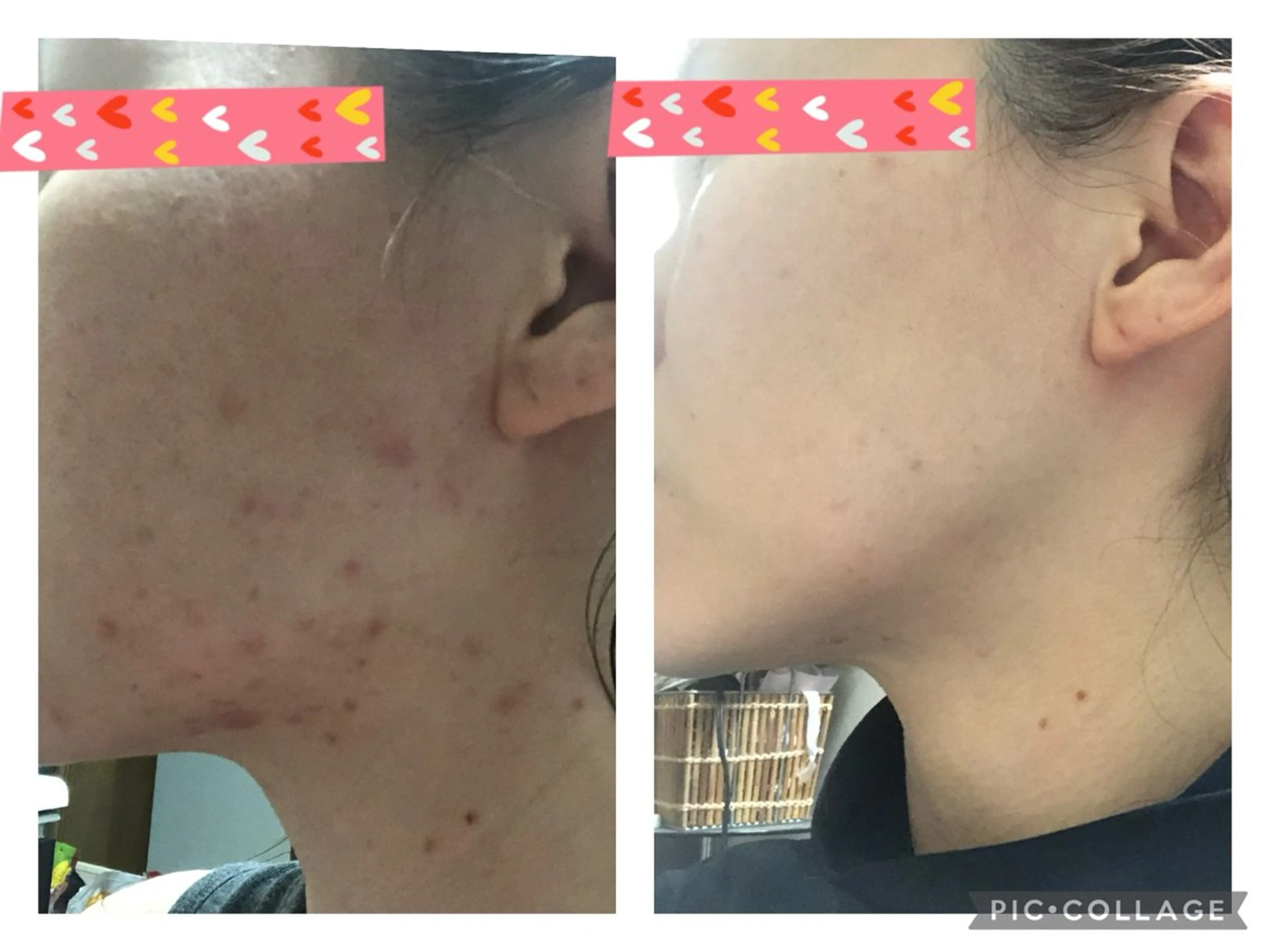 ヨサパーク  ルフ楢原店所属・水素×よもぎ蒸し YOSAPARKルフのエステ・リラクイメージ