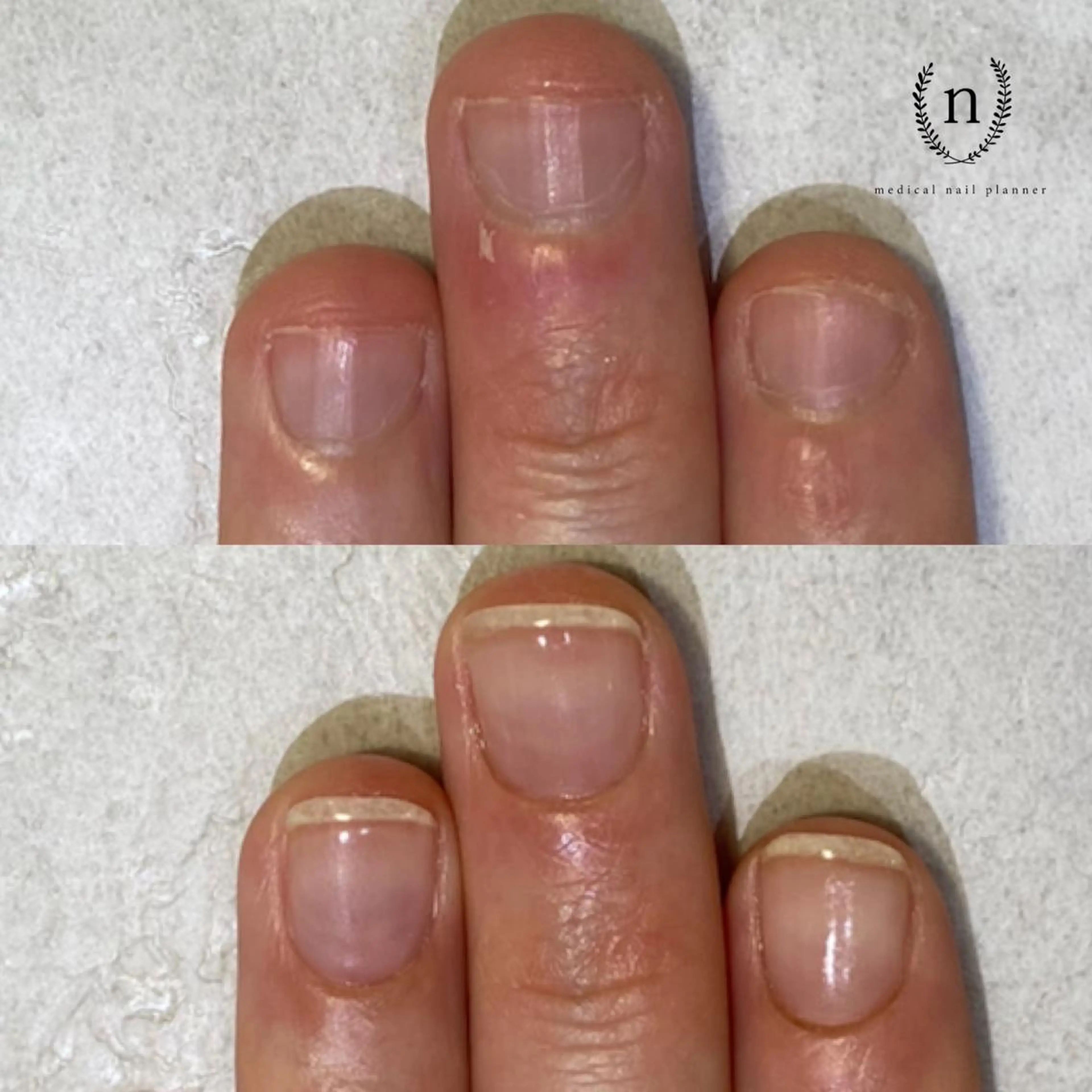 ネイル Rio 𓍼のネイルデザイン