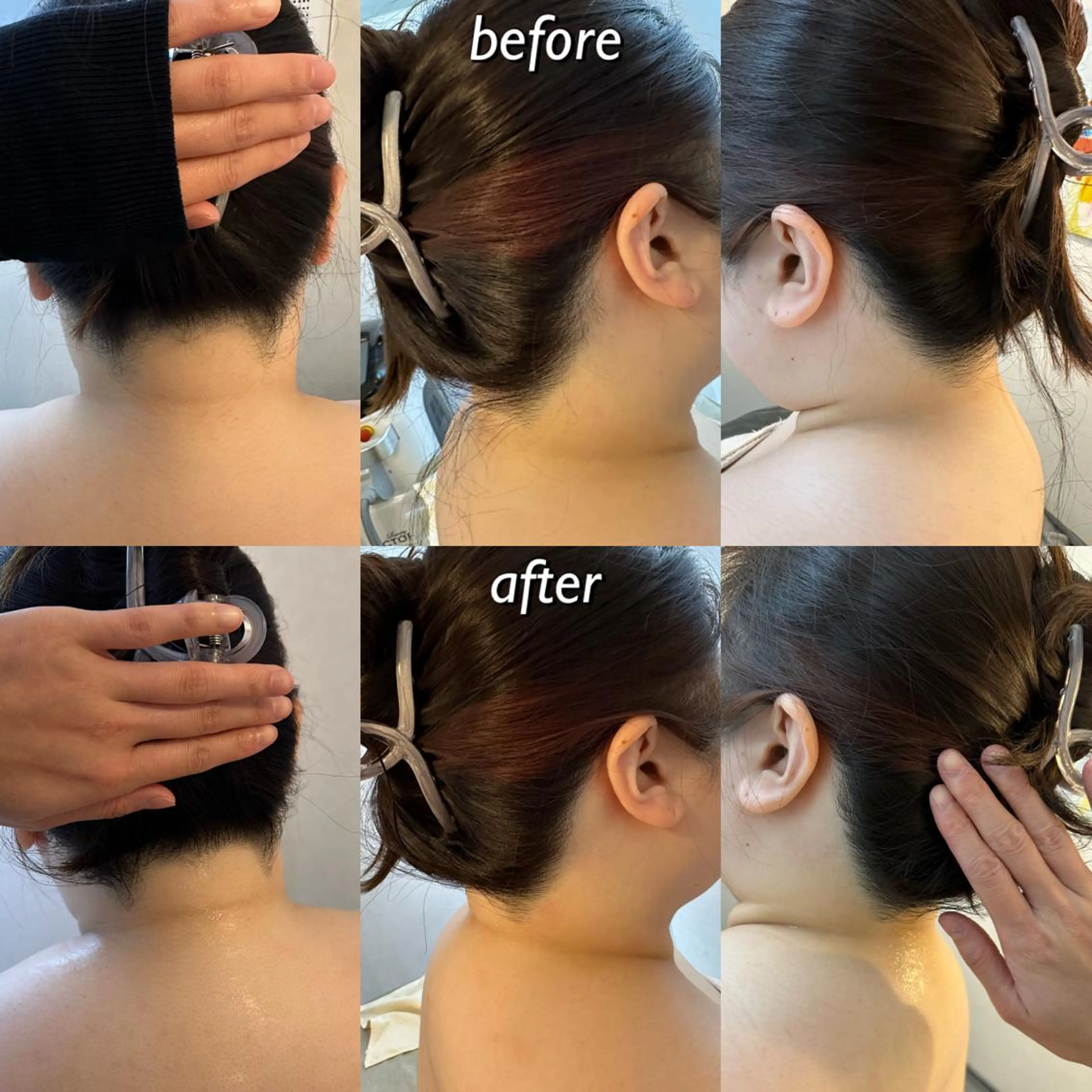 うなじ脱毛/美肌脱毛 LABELのエステ・リラクイメージ