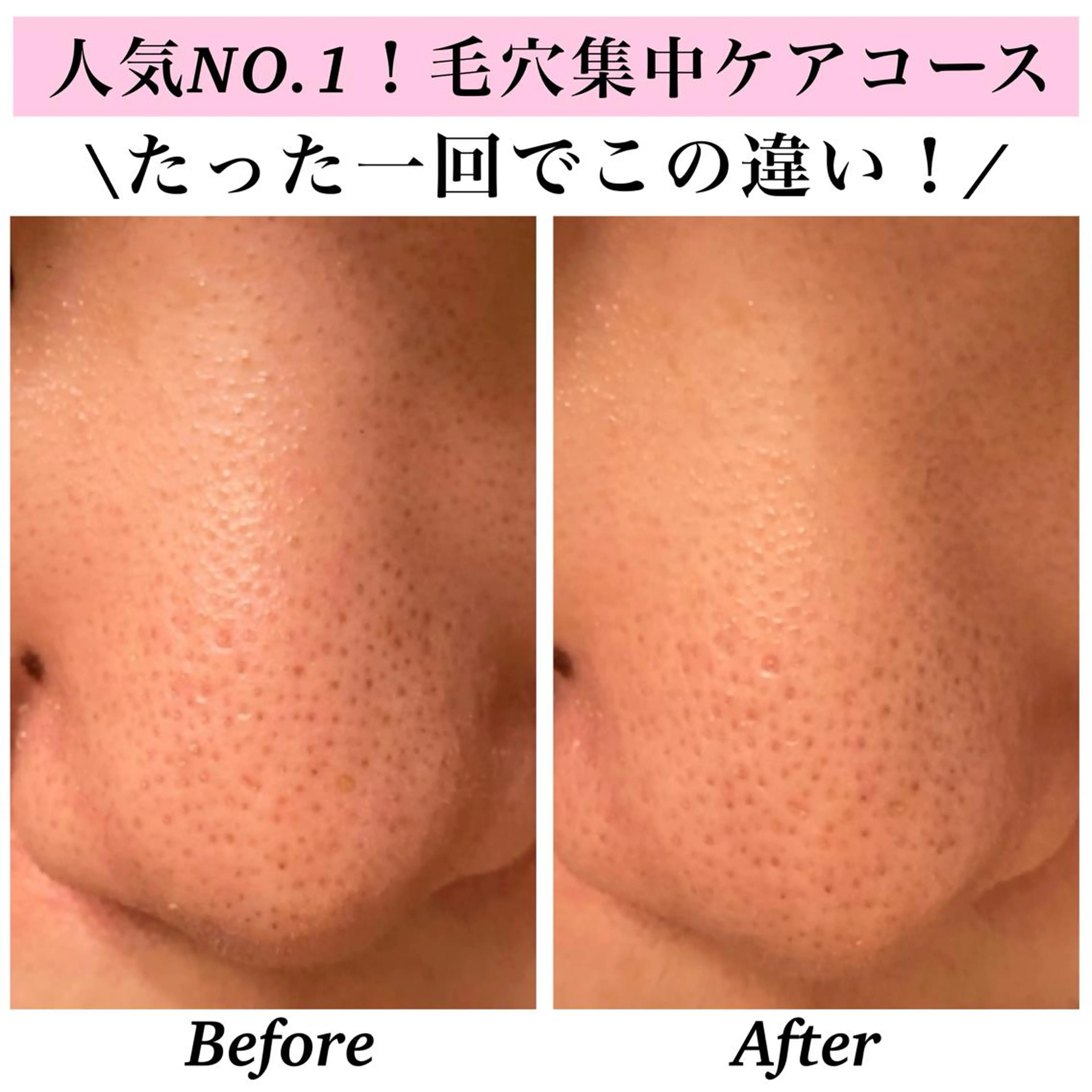 エステ リラク Bellesthe （ベルエステ）のエステ・リラクイメージ