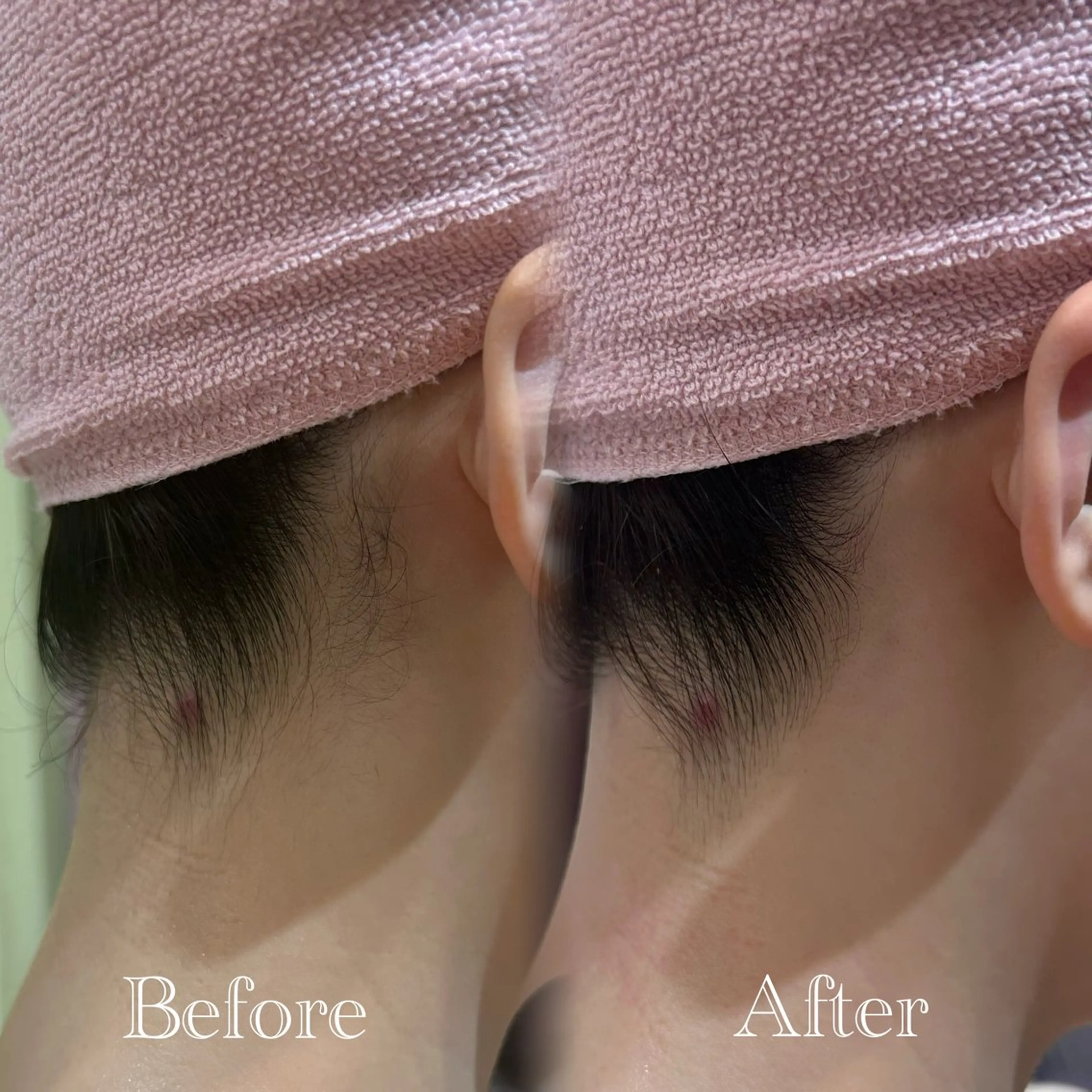 その他 🫧美しい素肌へ🫧 今成柚乃のその他イメージ