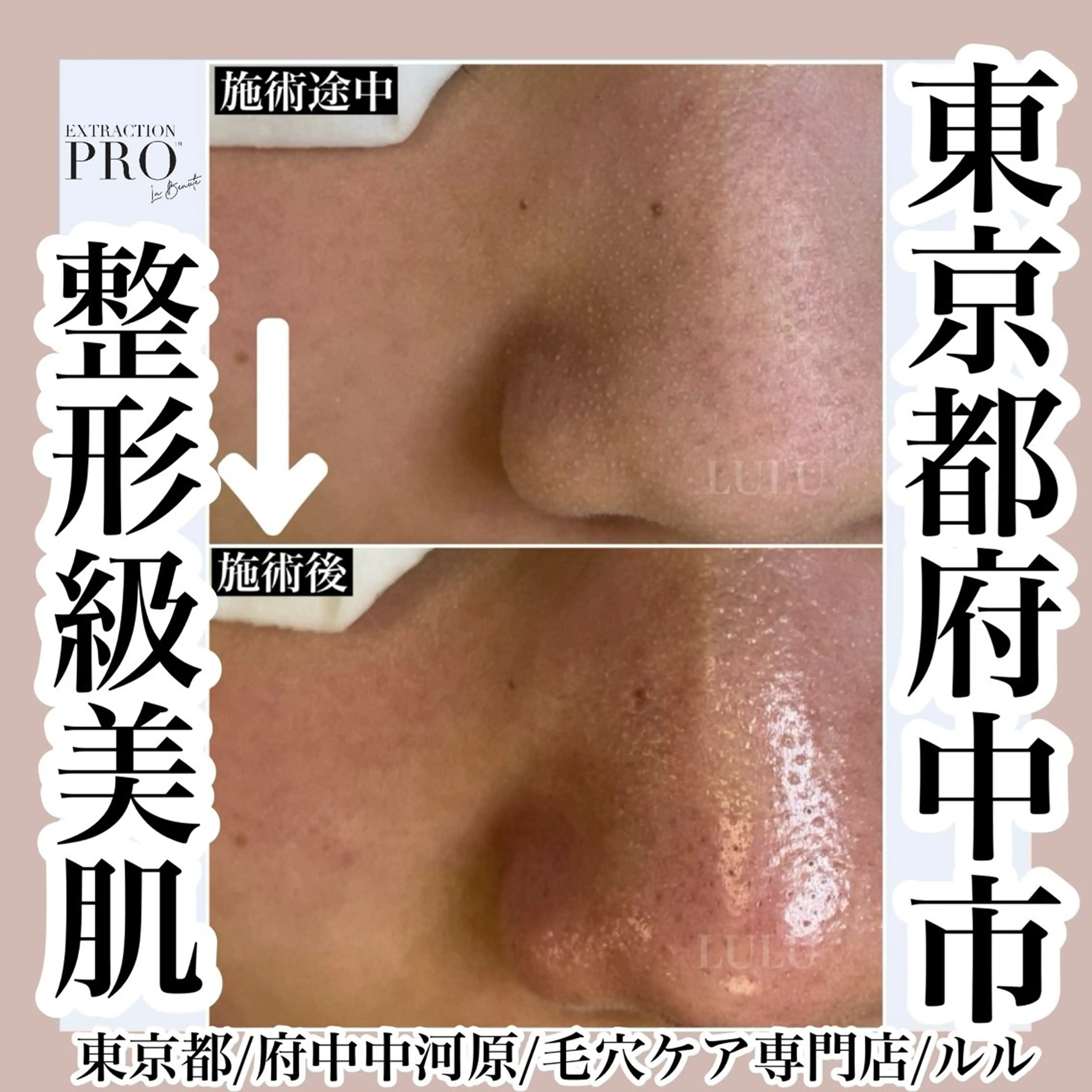 その他 LULU所属・LULU ルルのエステ・リラクイメージ