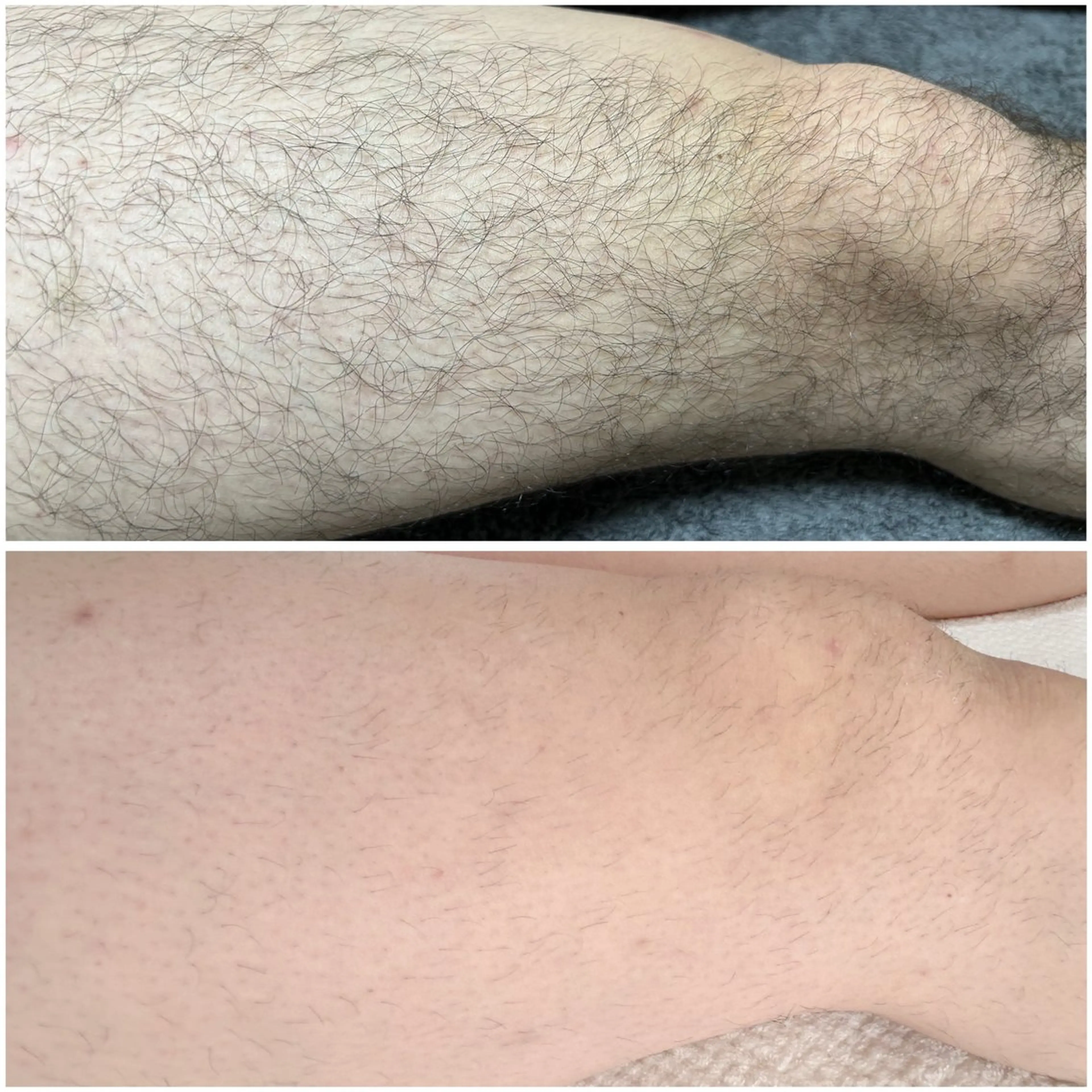 その他 宮代・脱毛サロンMIIN所属・地域最安値の脱毛と 韓国美容【MIIN】のエステ・リラクイメージ