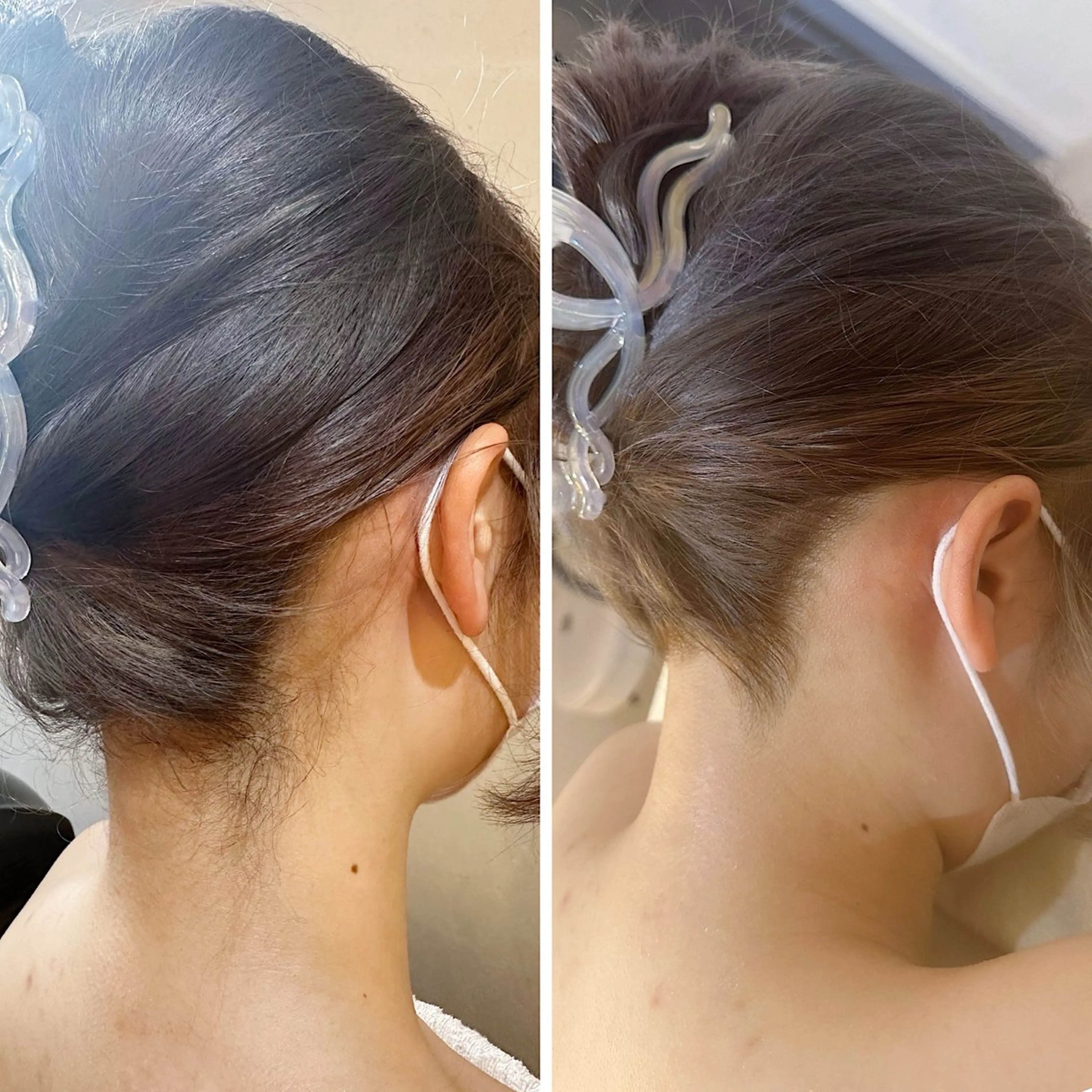 脱毛 うなじ脱毛/美肌脱毛 LABELのエステ・リラクイメージ