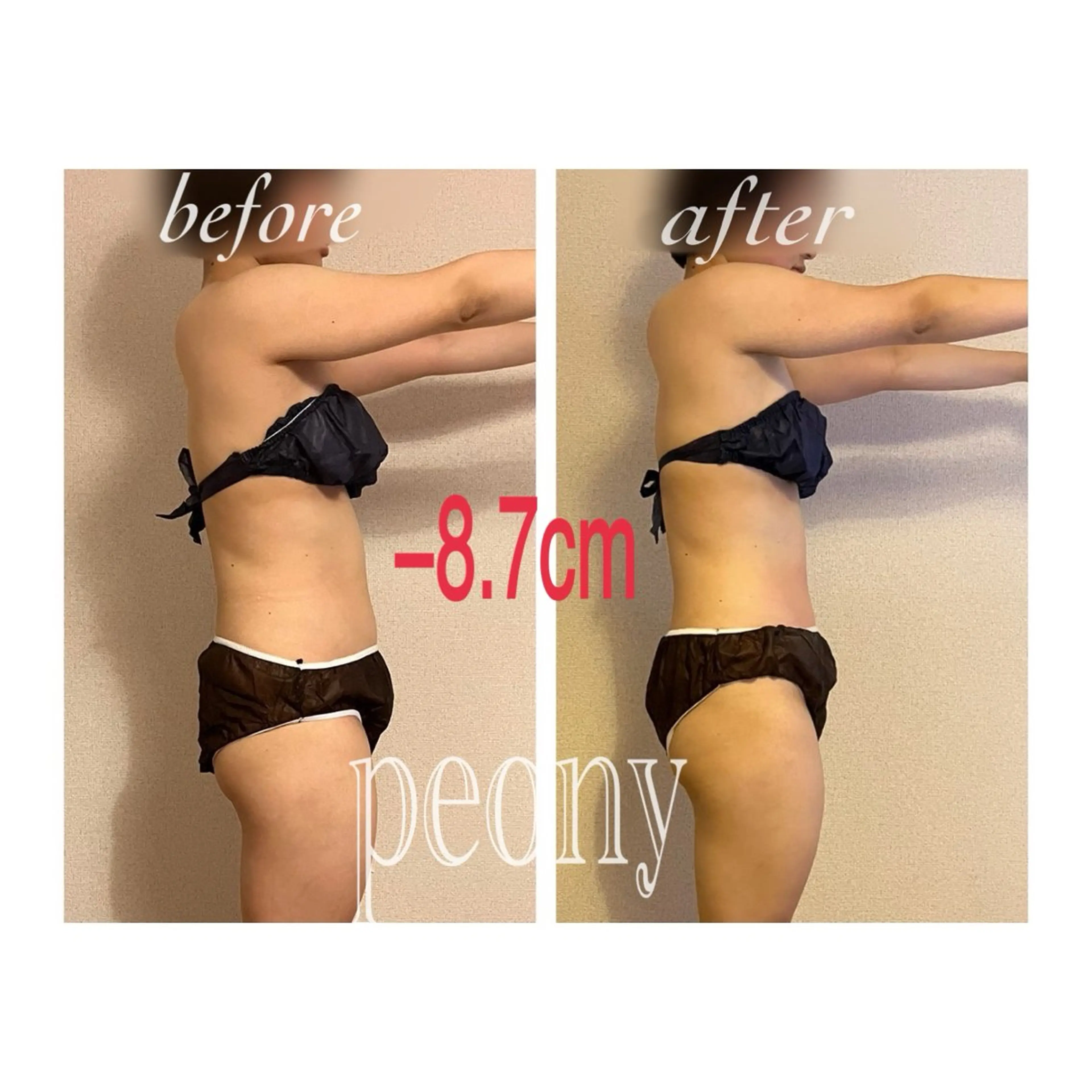 エステ デトックス美容専門サロンｐｅｏｎｙ所属・デトックス美容専門 サロンｐｅｏｎｙのエステ・リラクイメージ