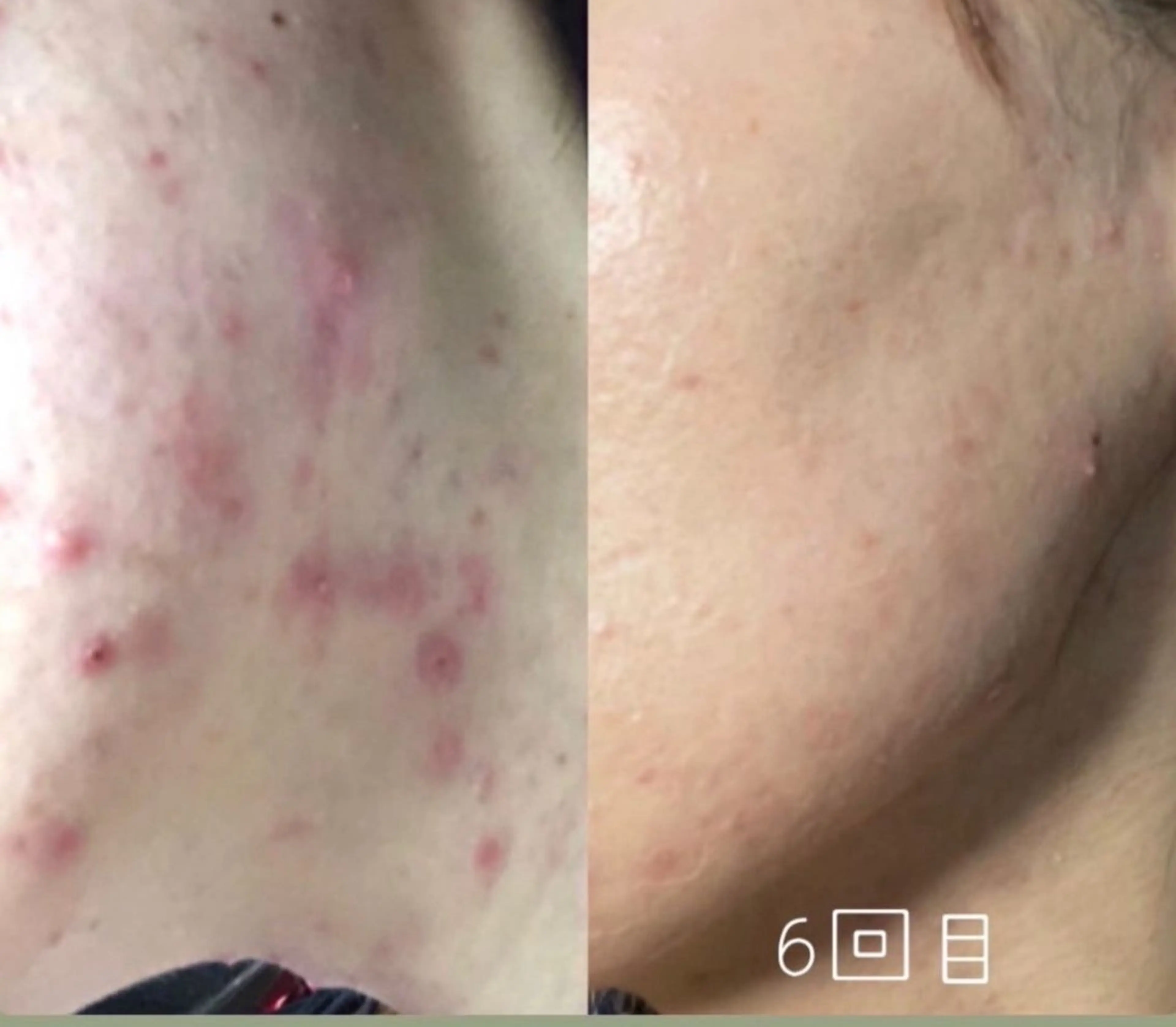 エステ Lei beauty salon所属・松ヤニワックス専門/ 梅田/Leiのエステ・リラクイメージ