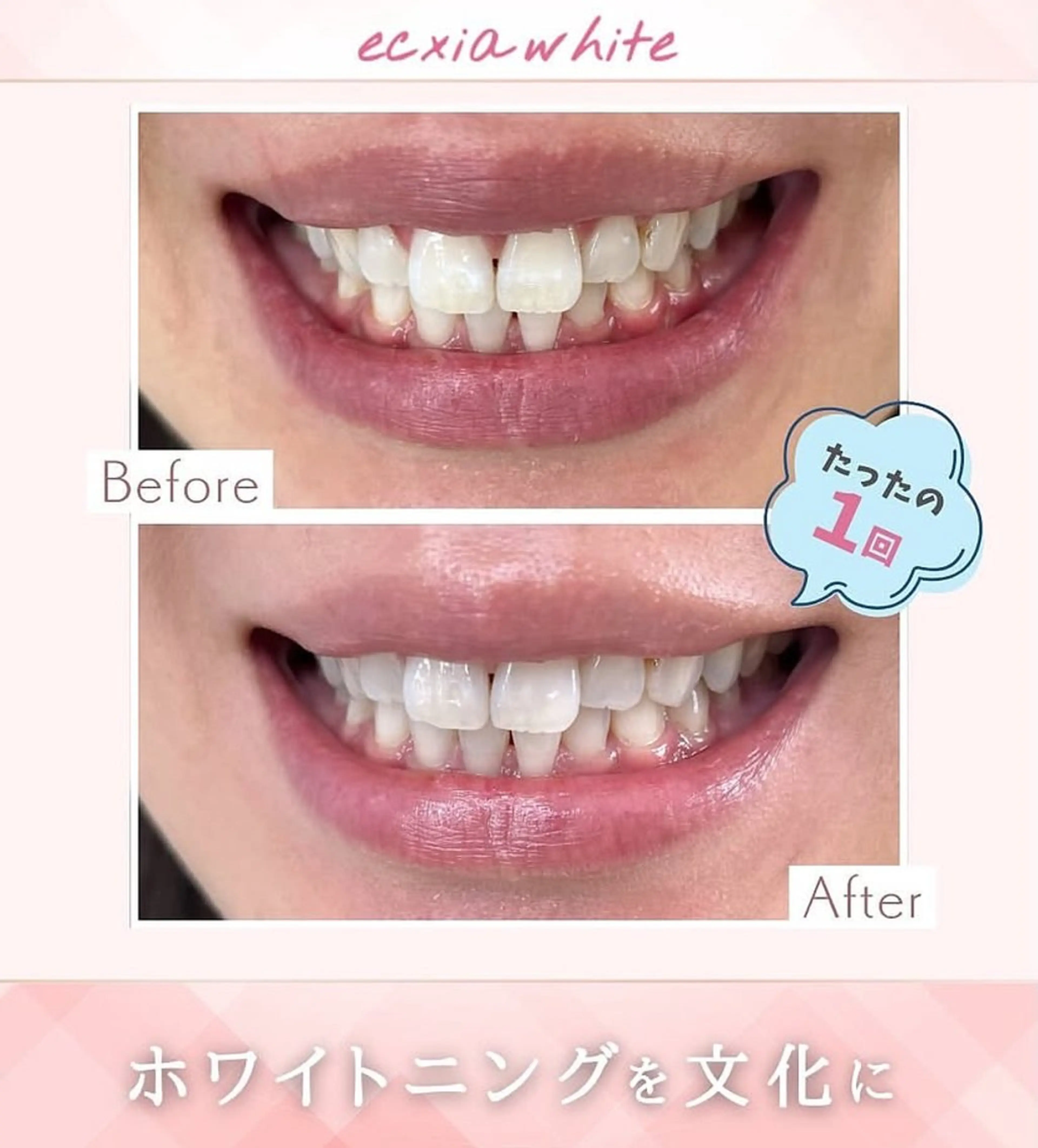 その他 エクシアホワイトニング草津店所属・nanami -ホワイトニングのその他イメージ