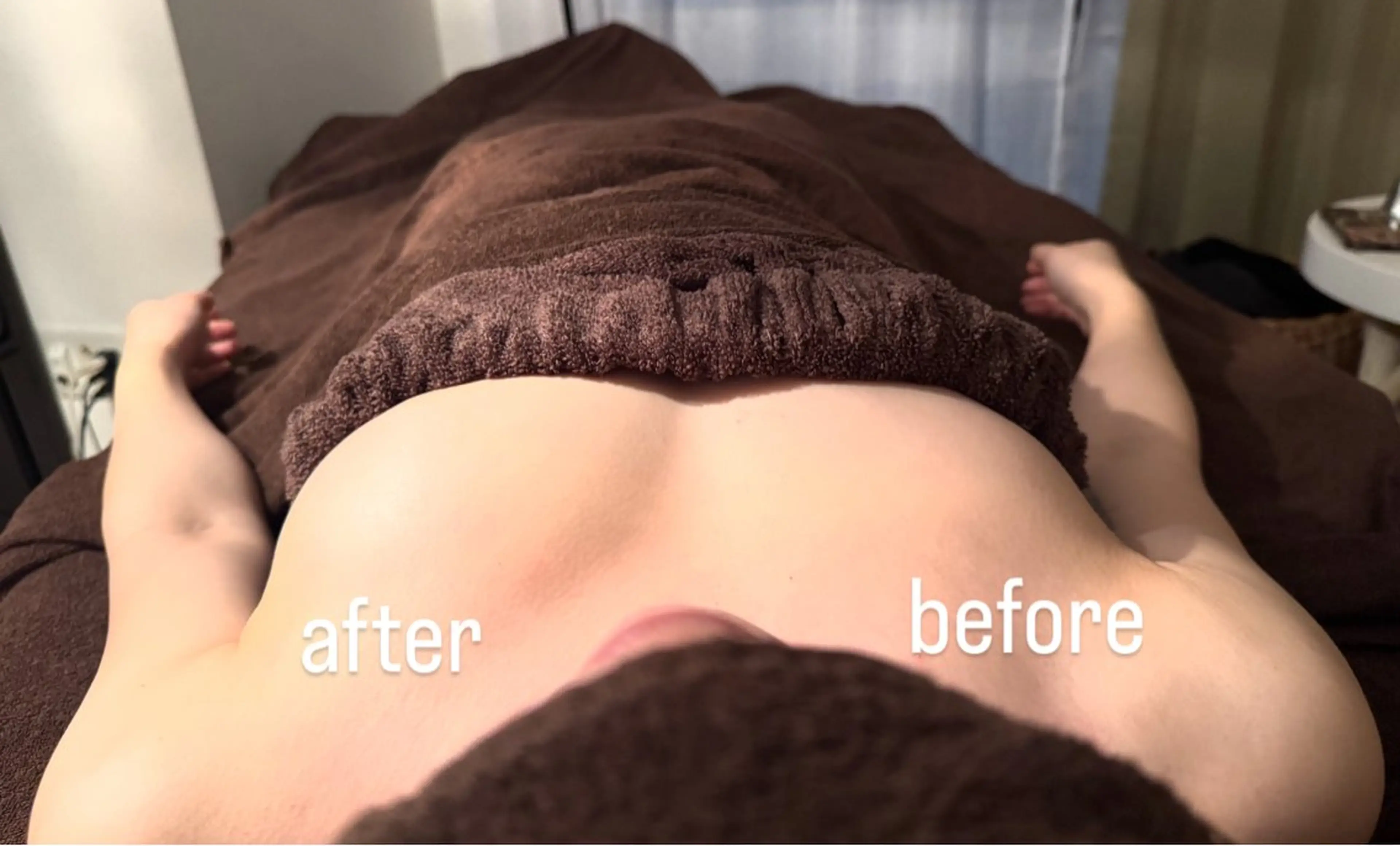 バストケアの写真