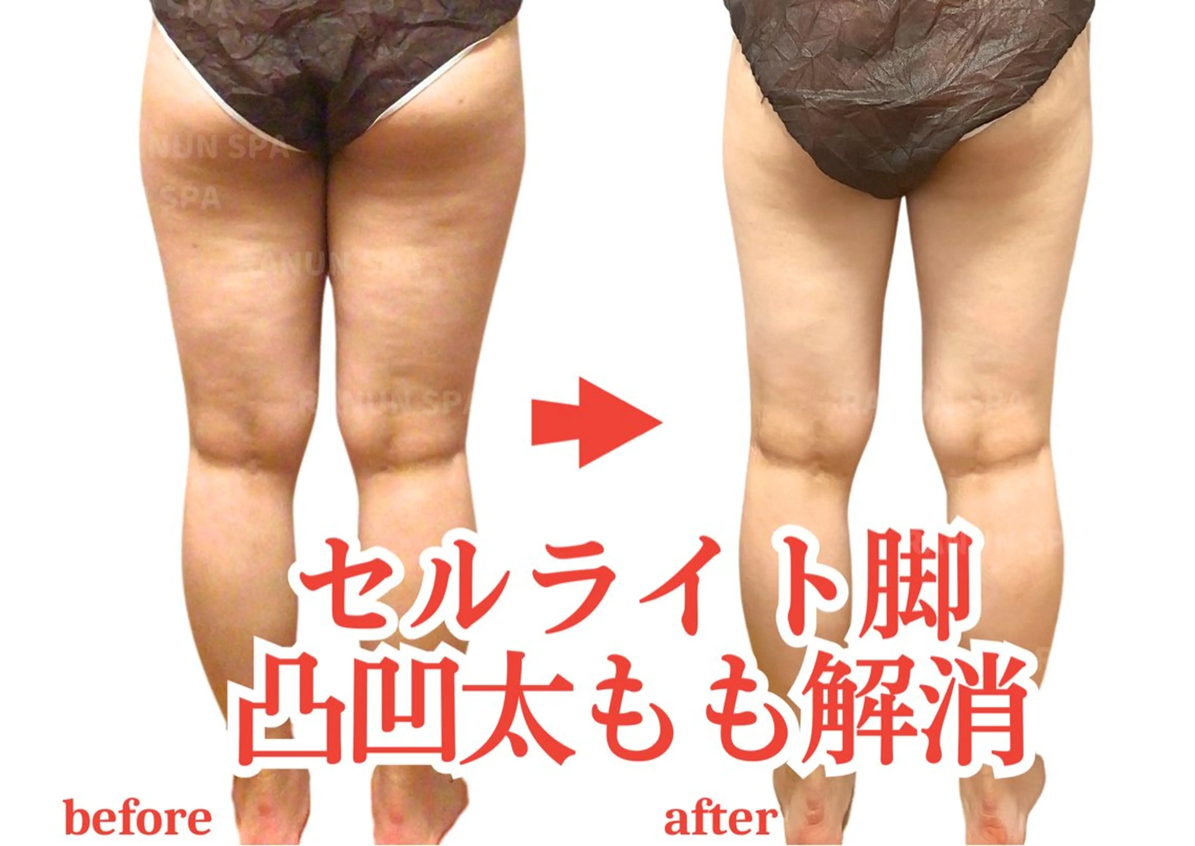 本気のリンパ痩身 ♦︎ラナンスパのエステ・リラクイメージ