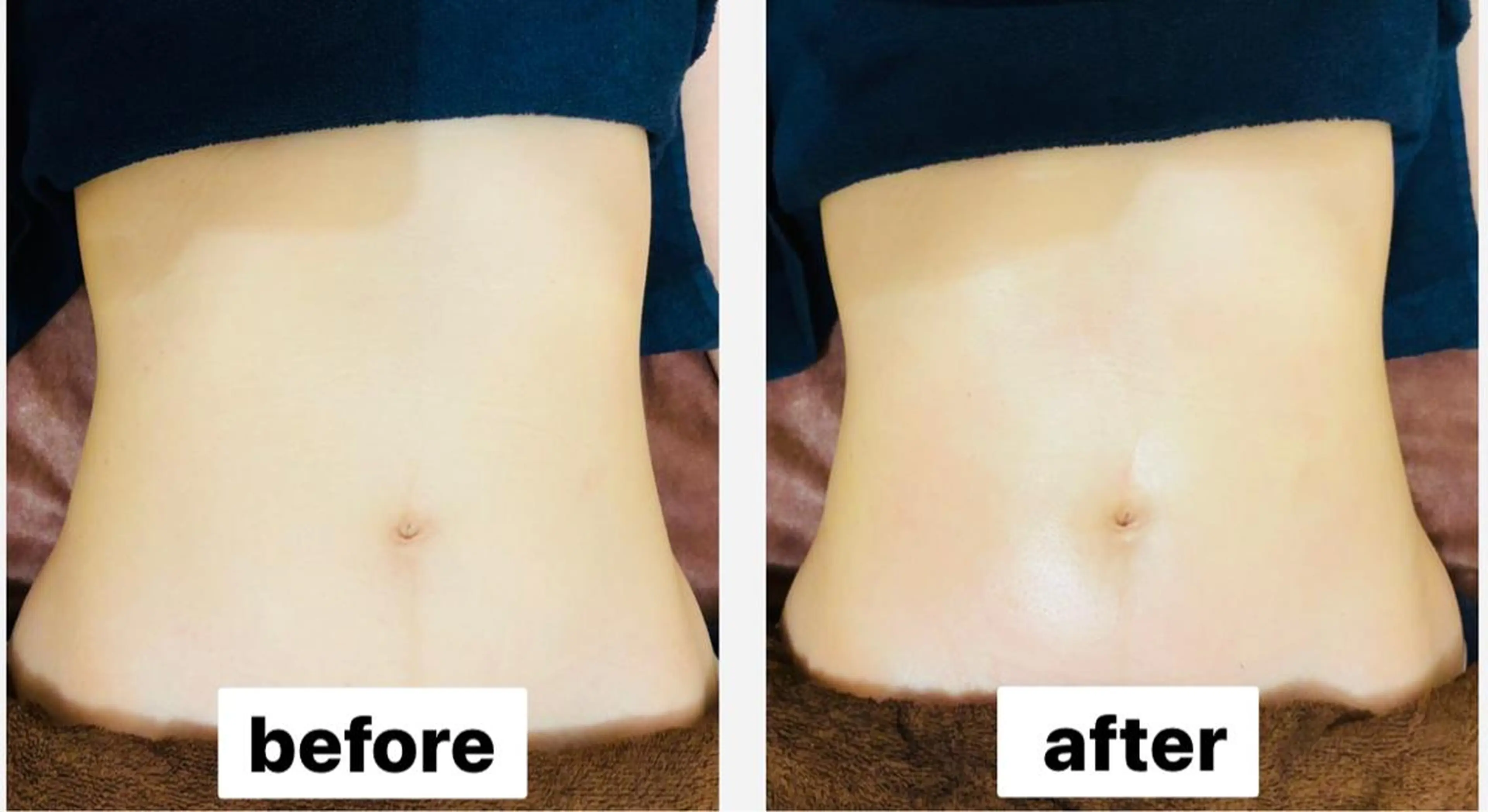 糸島 エステサロンmiuのエステ・リラクイメージ