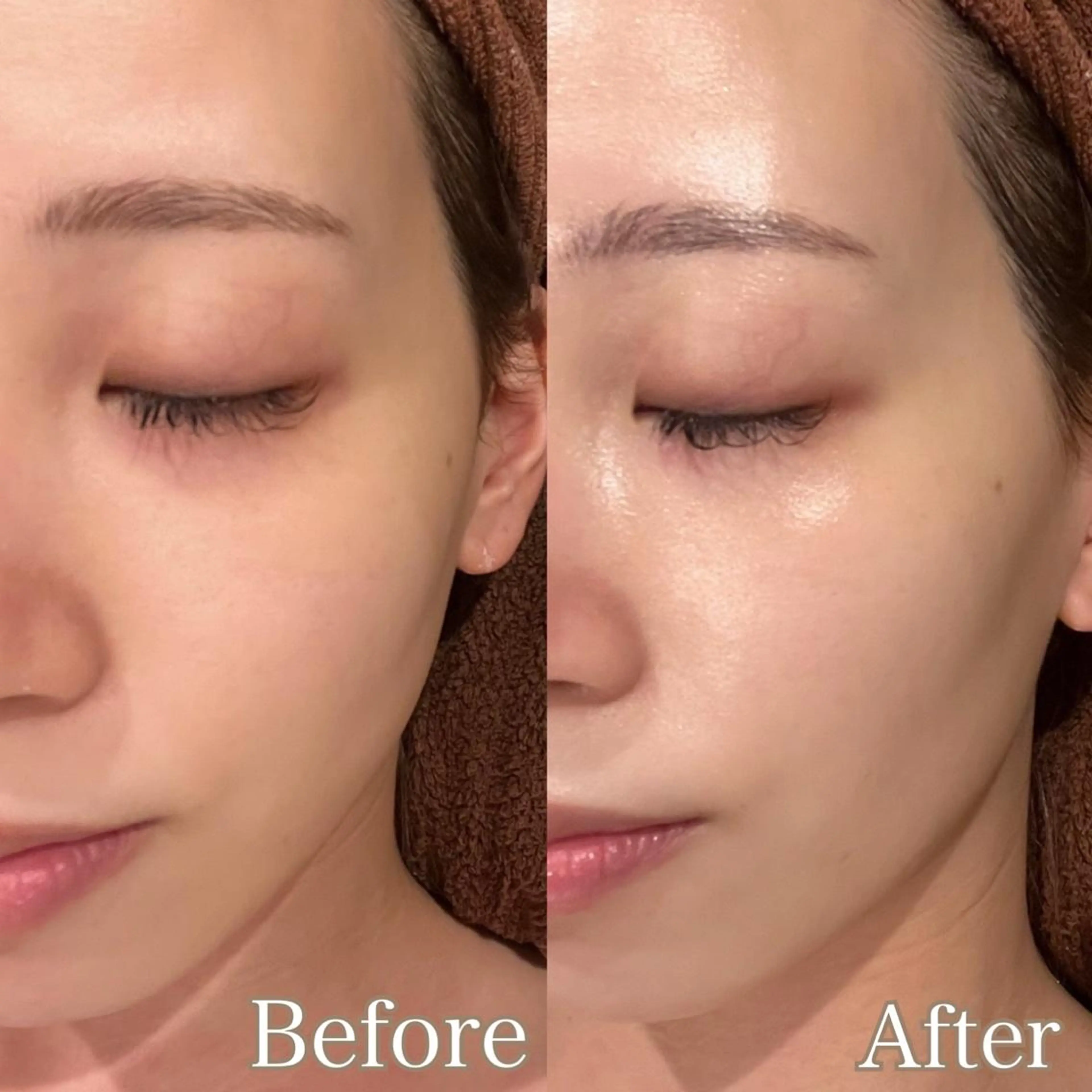 脱毛 ULULU上野店所属・ULULU 上野店のエステ・リラクイメージ