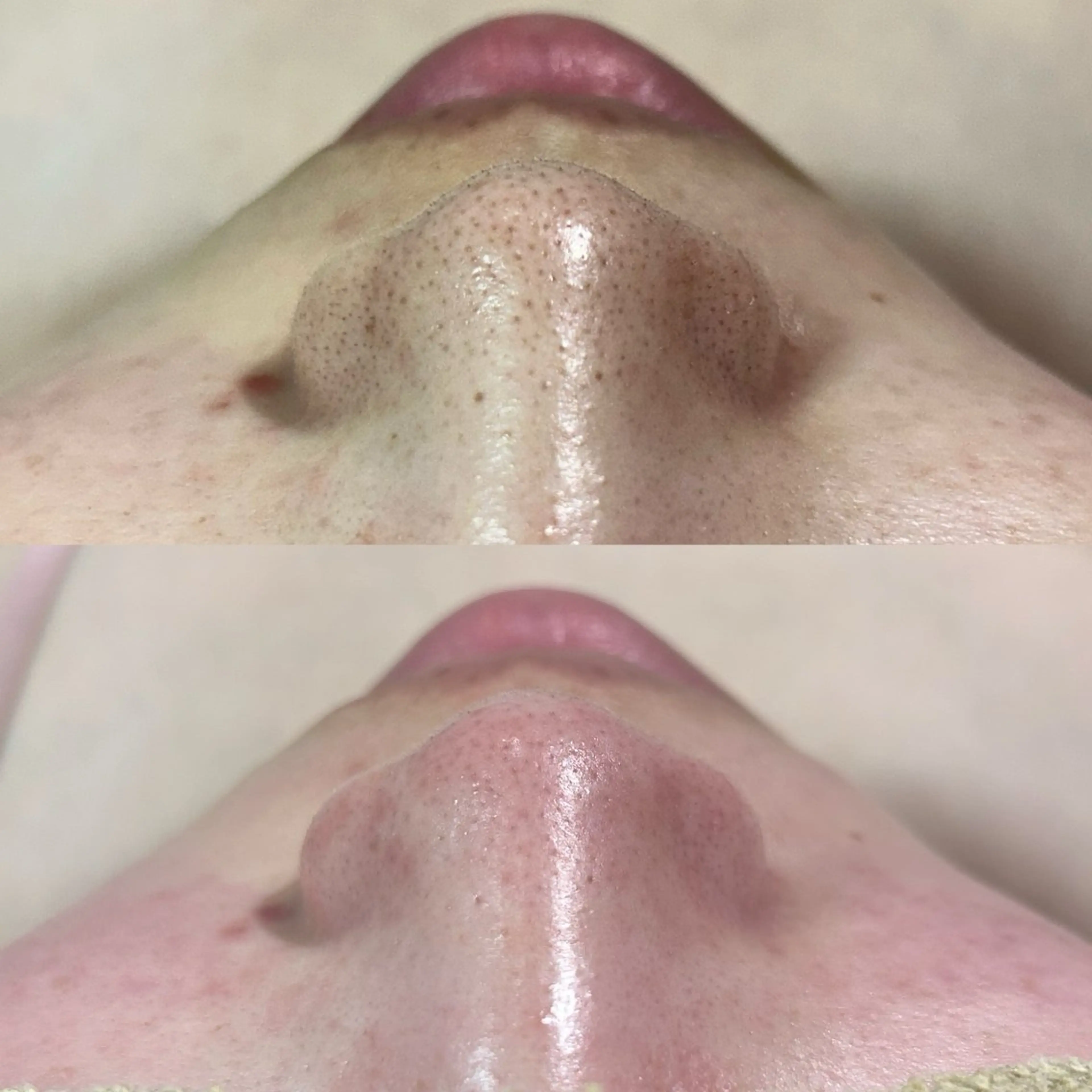 美肌脱毛&毛穴専門 Nico🐰ྀི♡のエステ・リラクイメージ