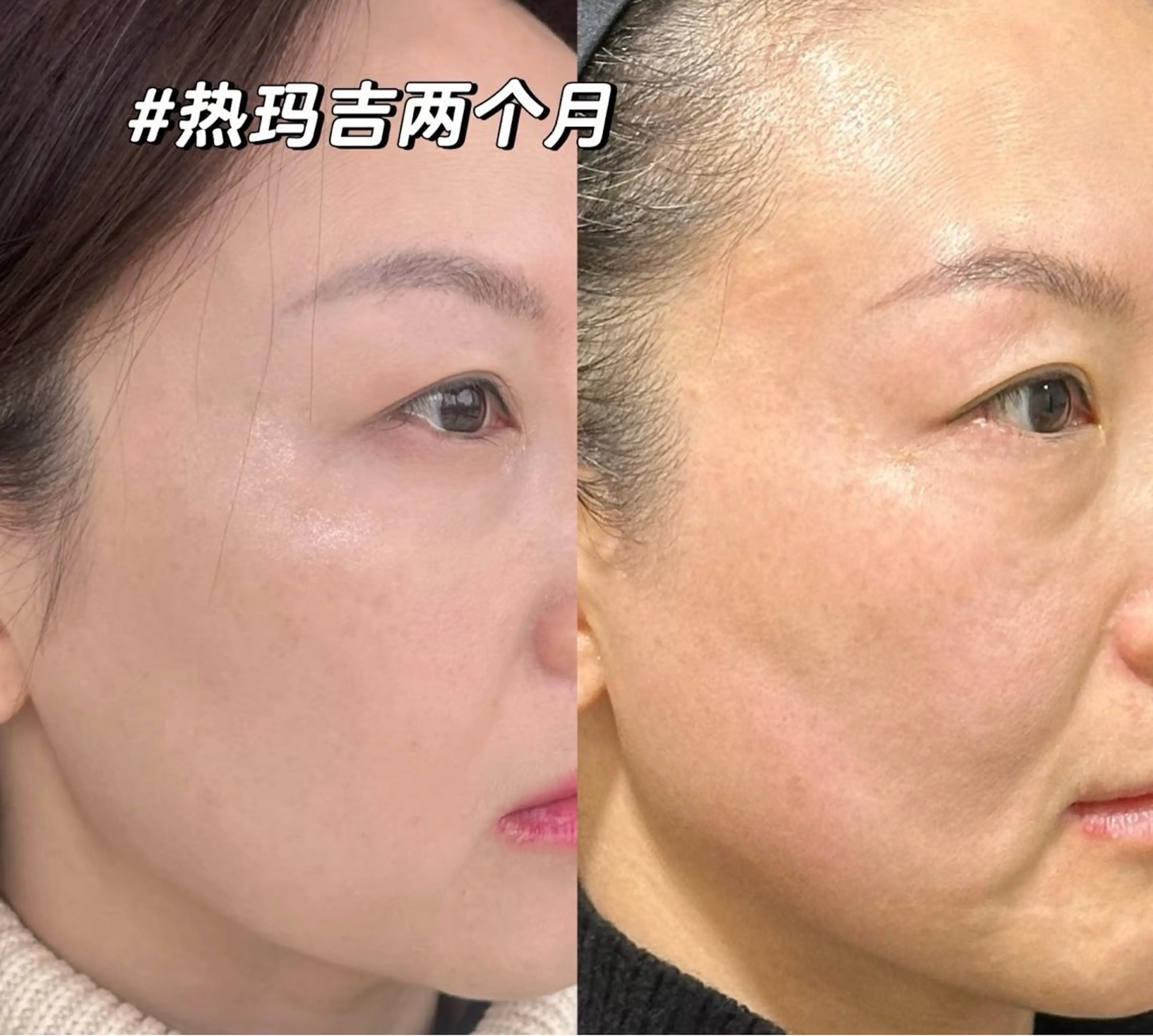 マツエク・マツパ エステ aliaハイフ&水光ジェットサロン所属・aliaハーブ水光店 エステティシャン募集のエステ・リラクイメージ