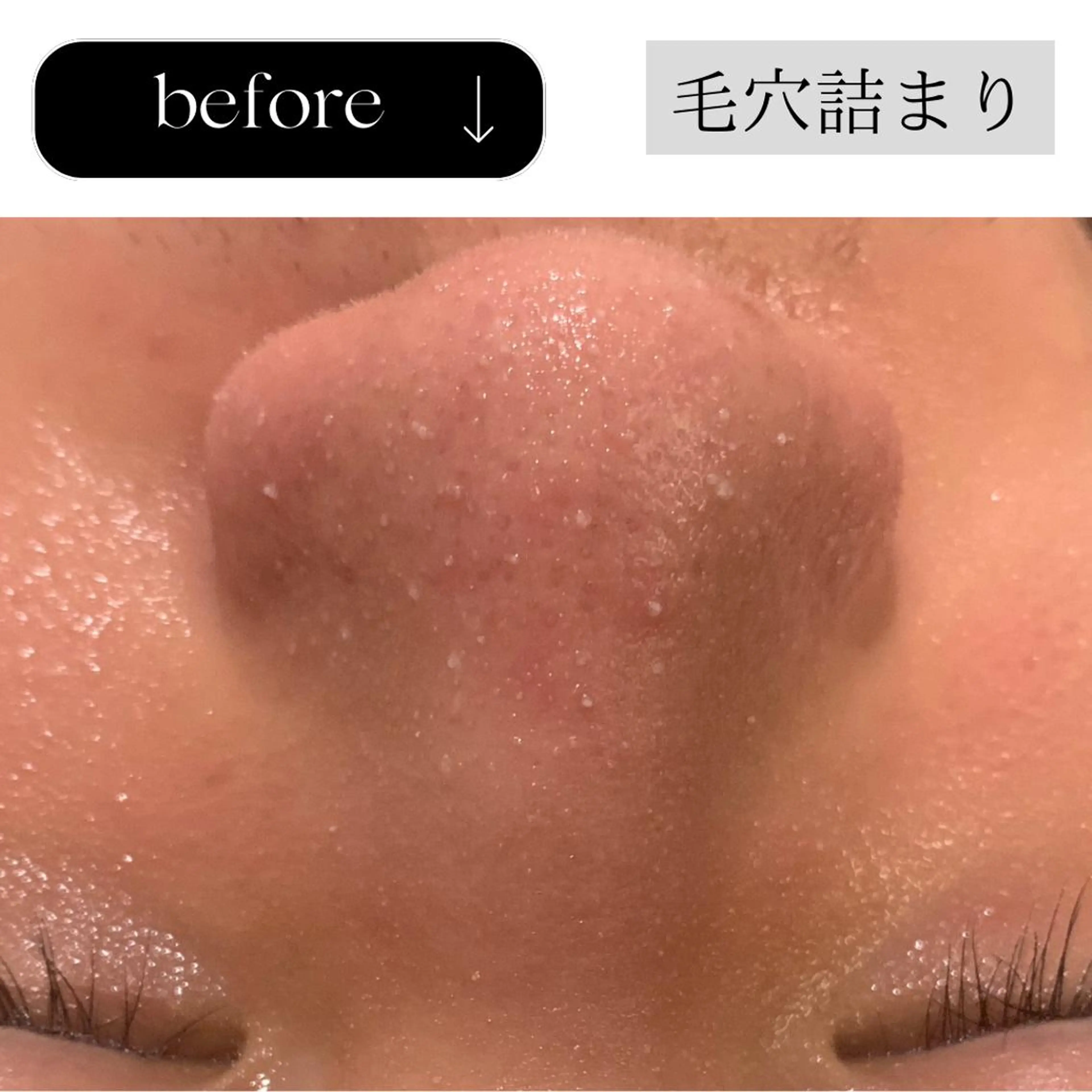 beauty CHOOSEのマツエク・マツパデザイン