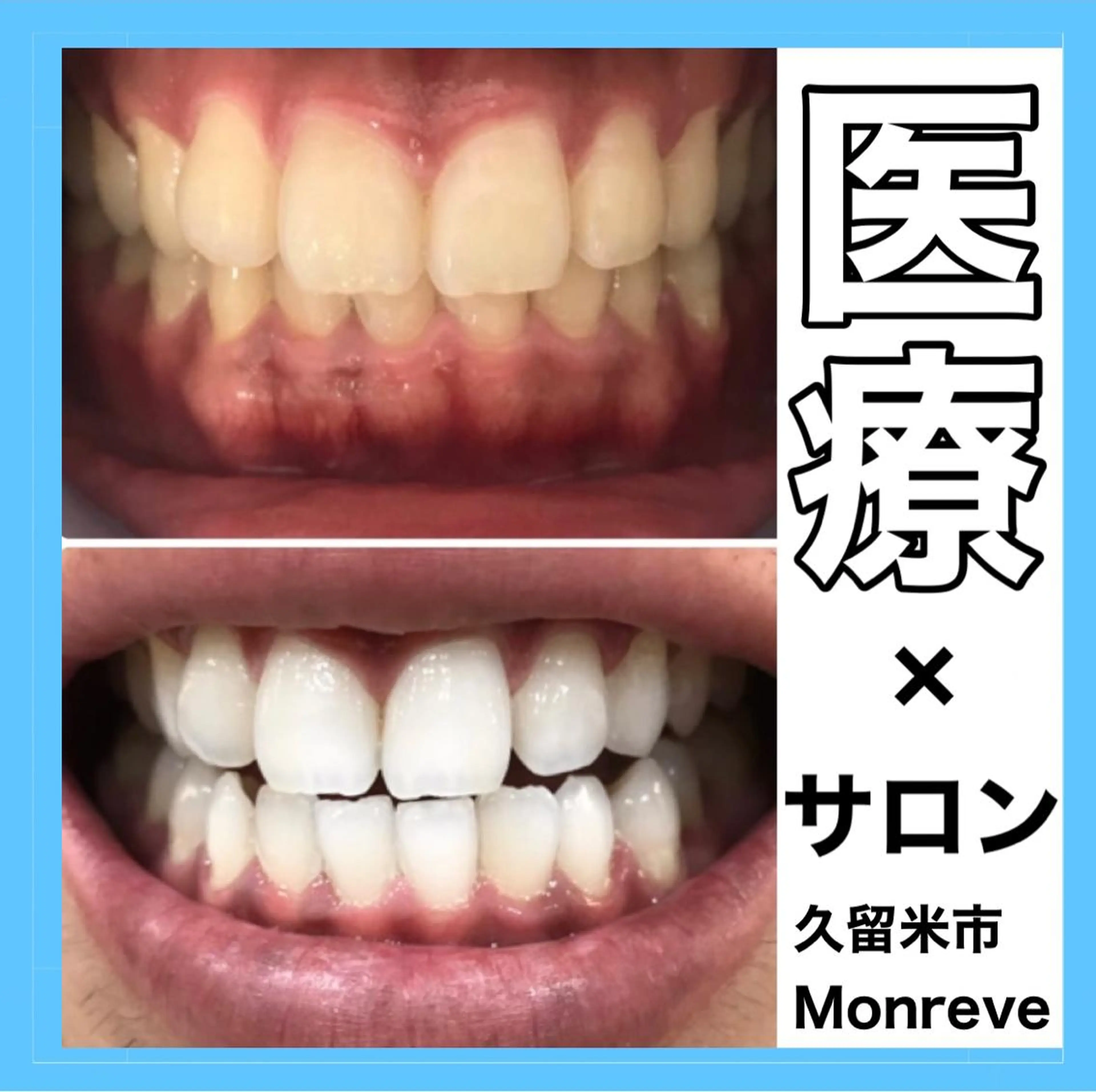 Monreve所属・美人スイッチdiet スーパージェクションのその他イメージ