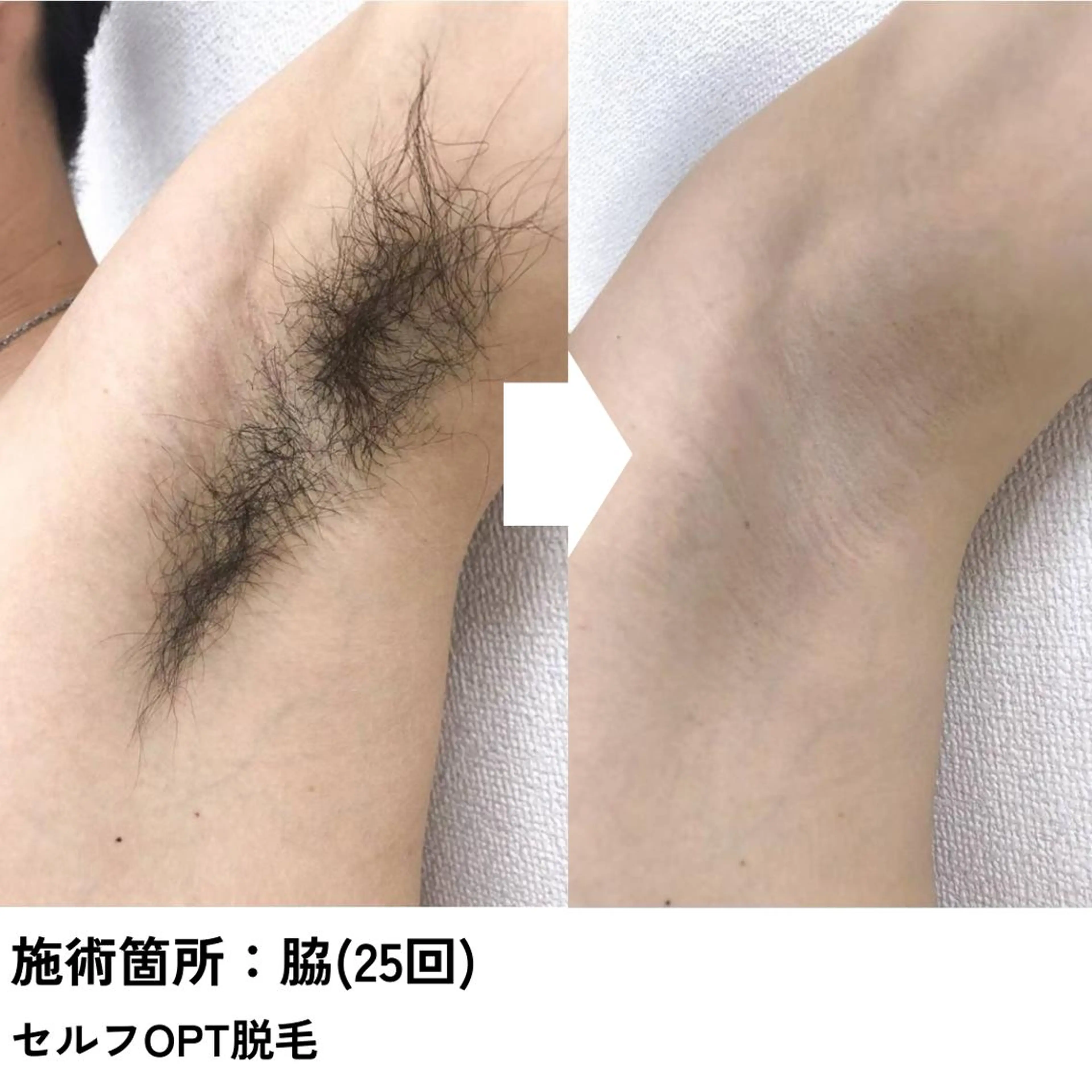 メンズ 脱毛 B-st. 下北沢のその他イメージ