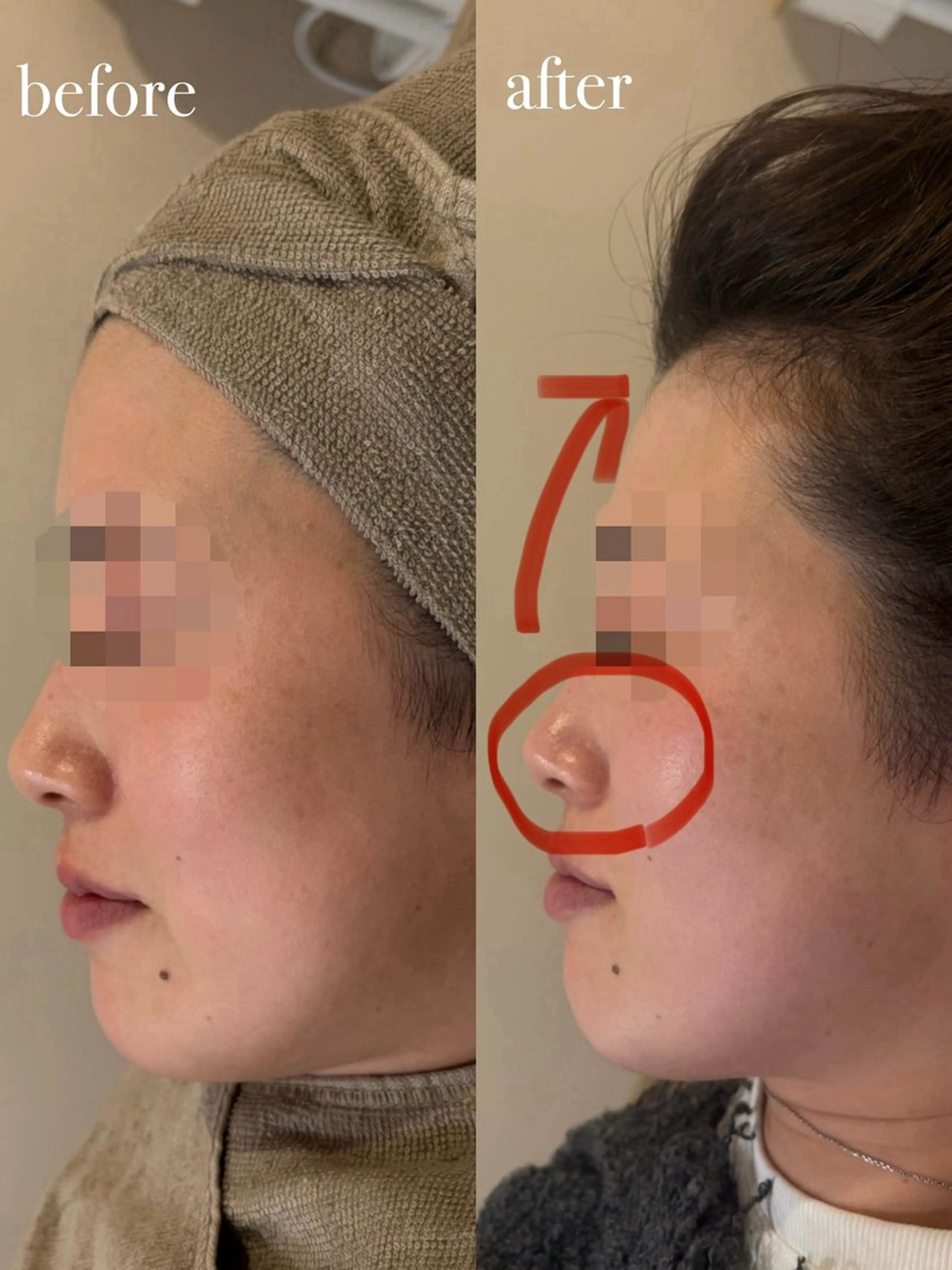 ENNE Lash&Blow by&ERA所属・ENNE🦩小顔整体 師🌿 HINAKOのエステ・リラクイメージ