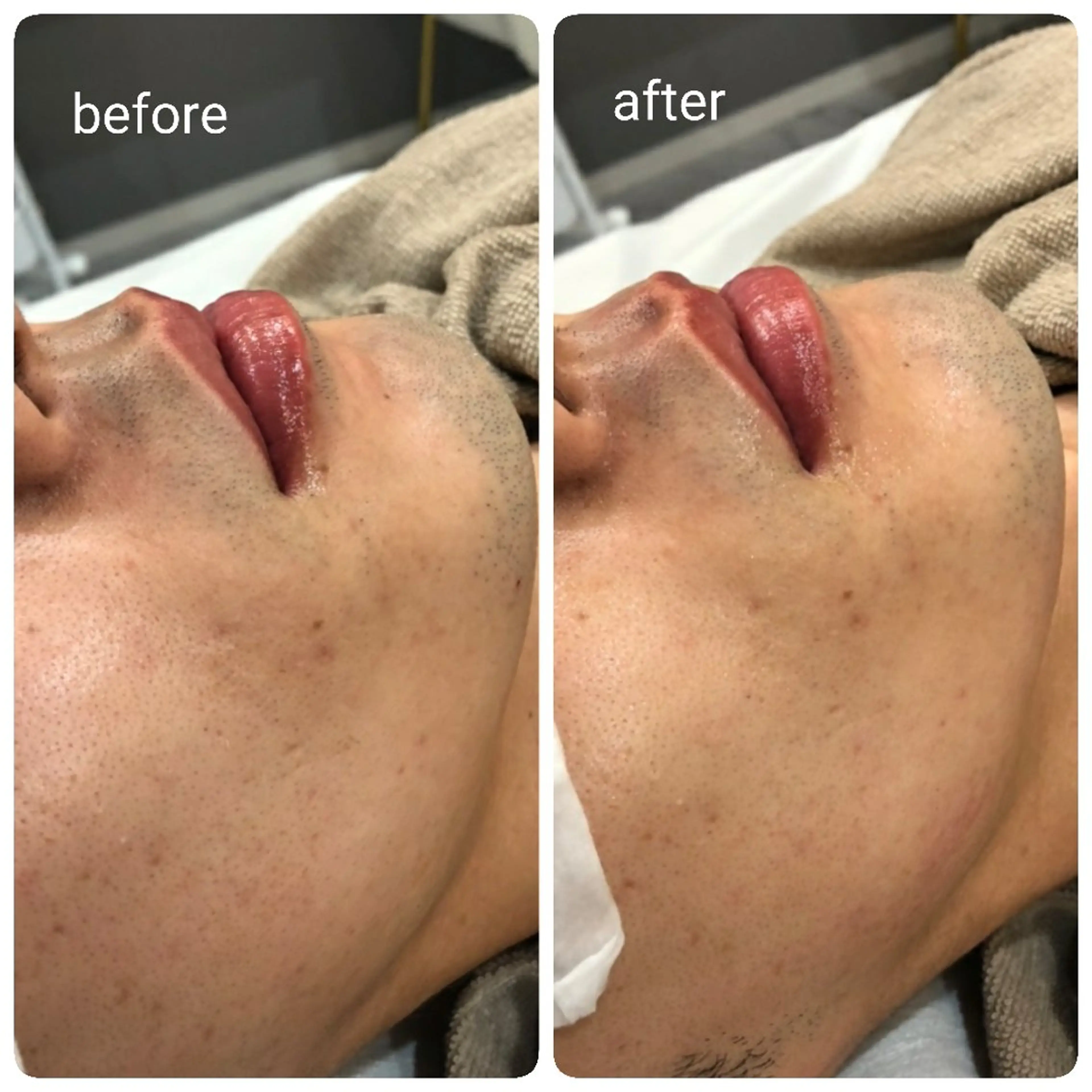 キッズ 脱毛 N.Sサロン Miyauchiのエステ・リラクイメージ