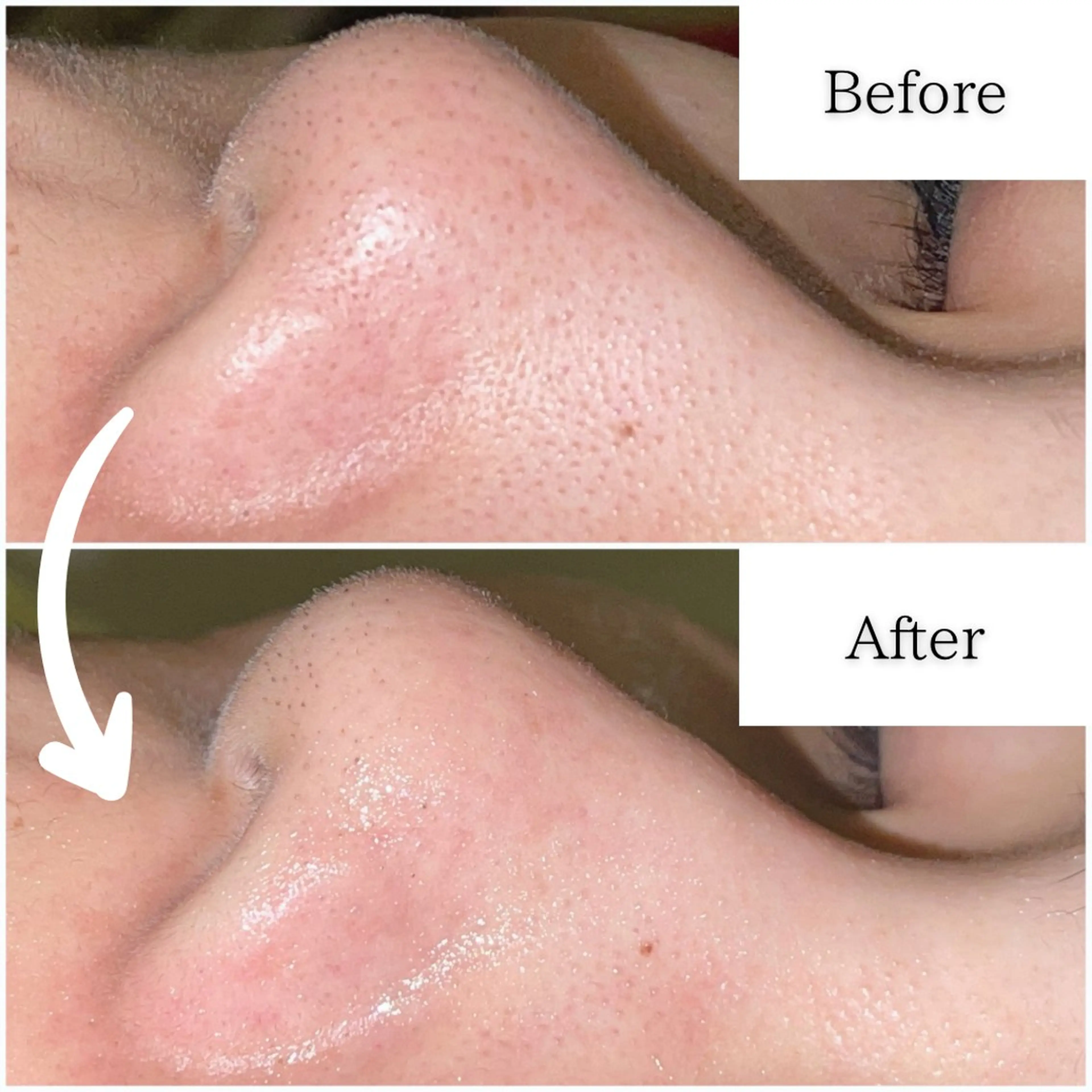 エステ SELF  BEAUTY gracia浦添店所属・gracia 浦添店のその他イメージ