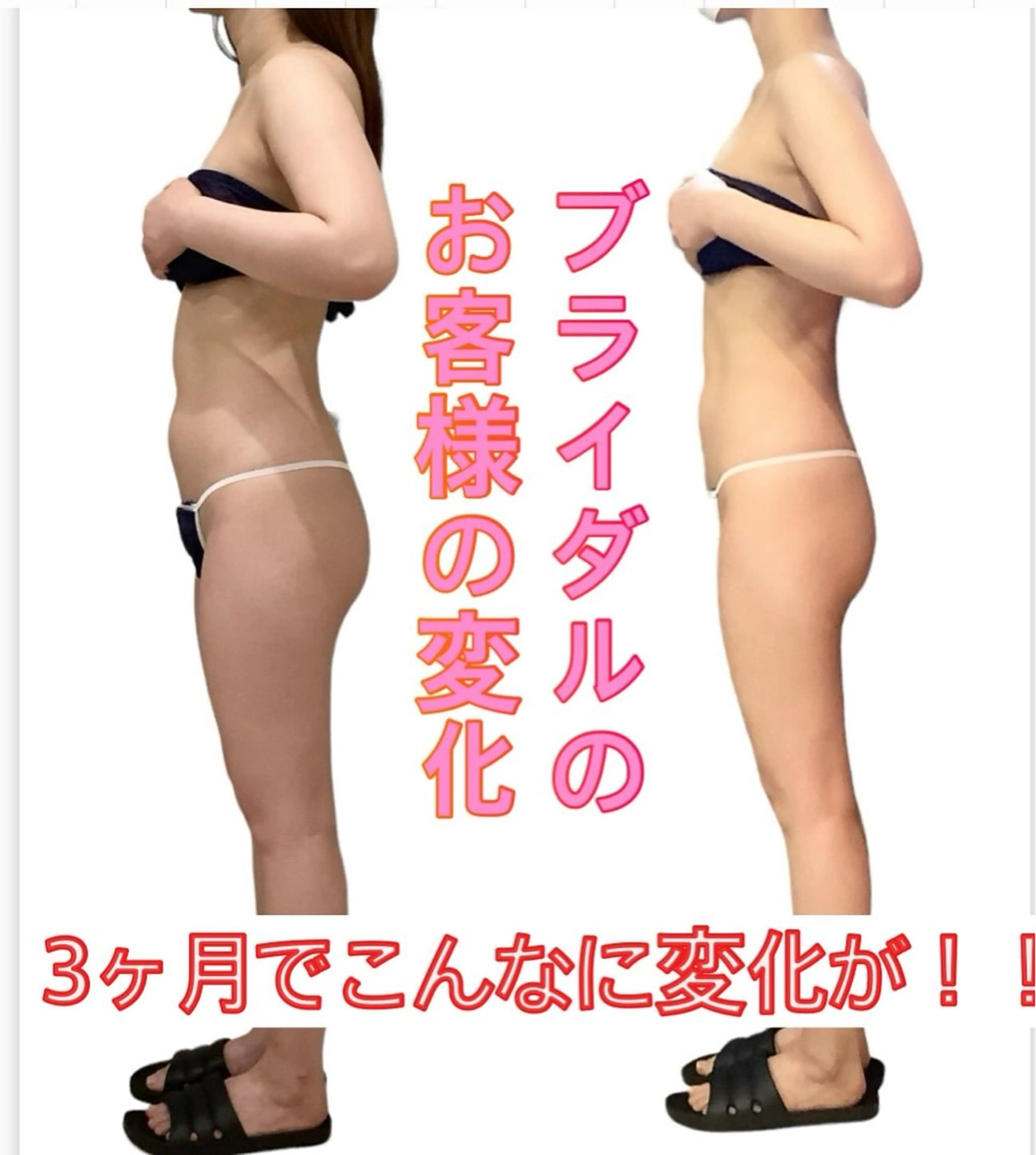 痩身ダイエット&小顔専門店Rs slim（アールズスリム）所属・痩身ダイエット&小顔 🩷アールズスリムのエステ・リラクイメージ