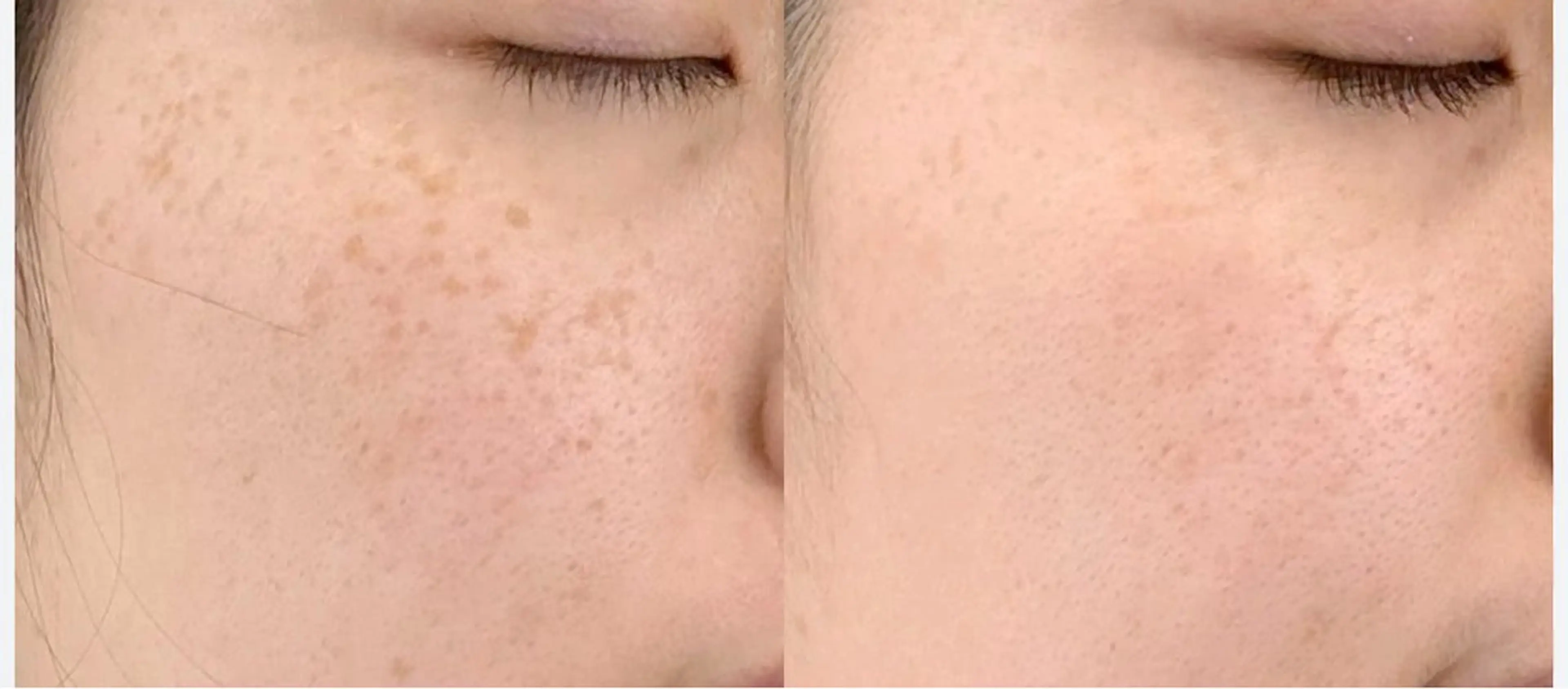 エステ 肌質改善sui所属・肌質改善 suiのエステ・リラクイメージ