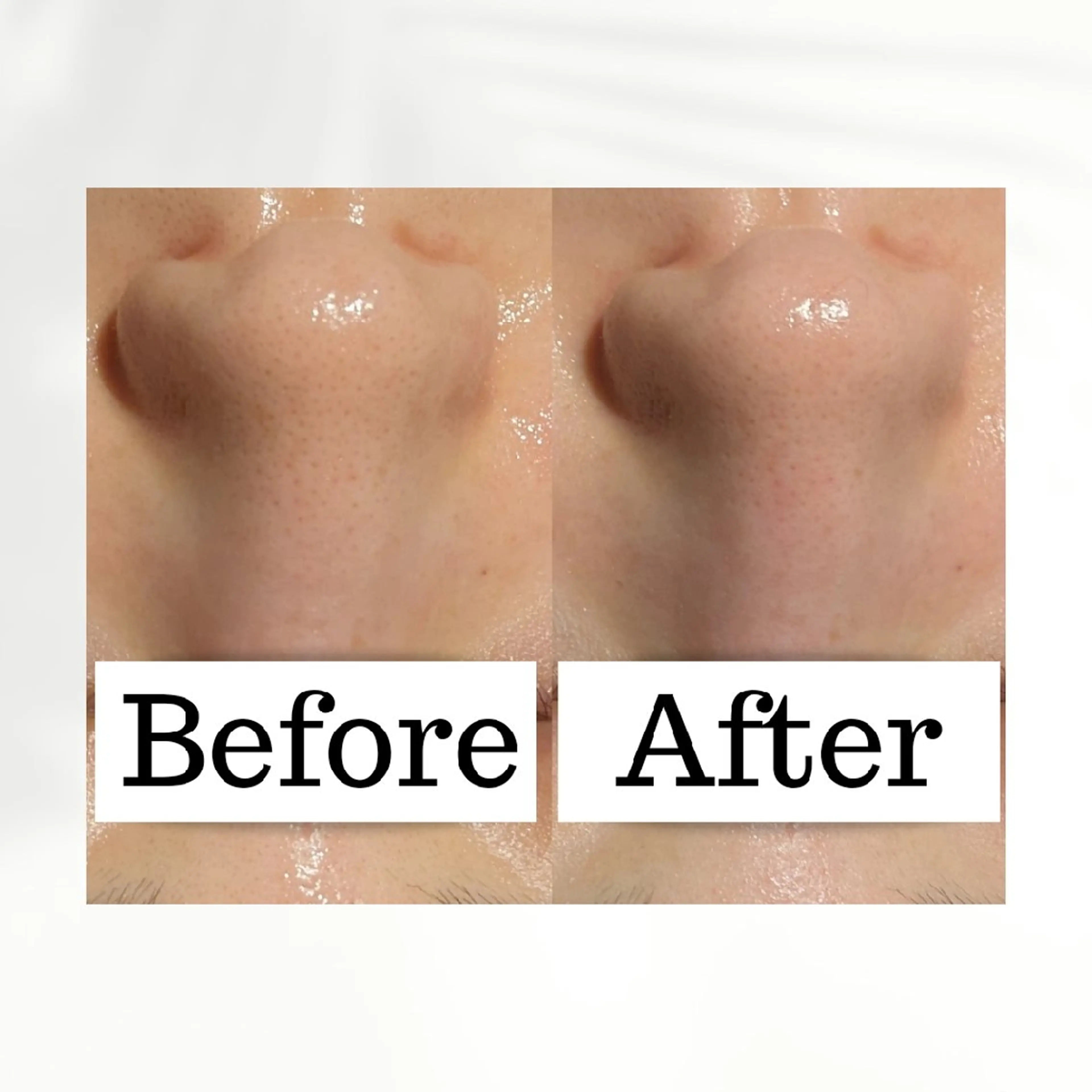 エステ 肌管理専門！BACI 加盟店LUANAのエステ・リラクイメージ