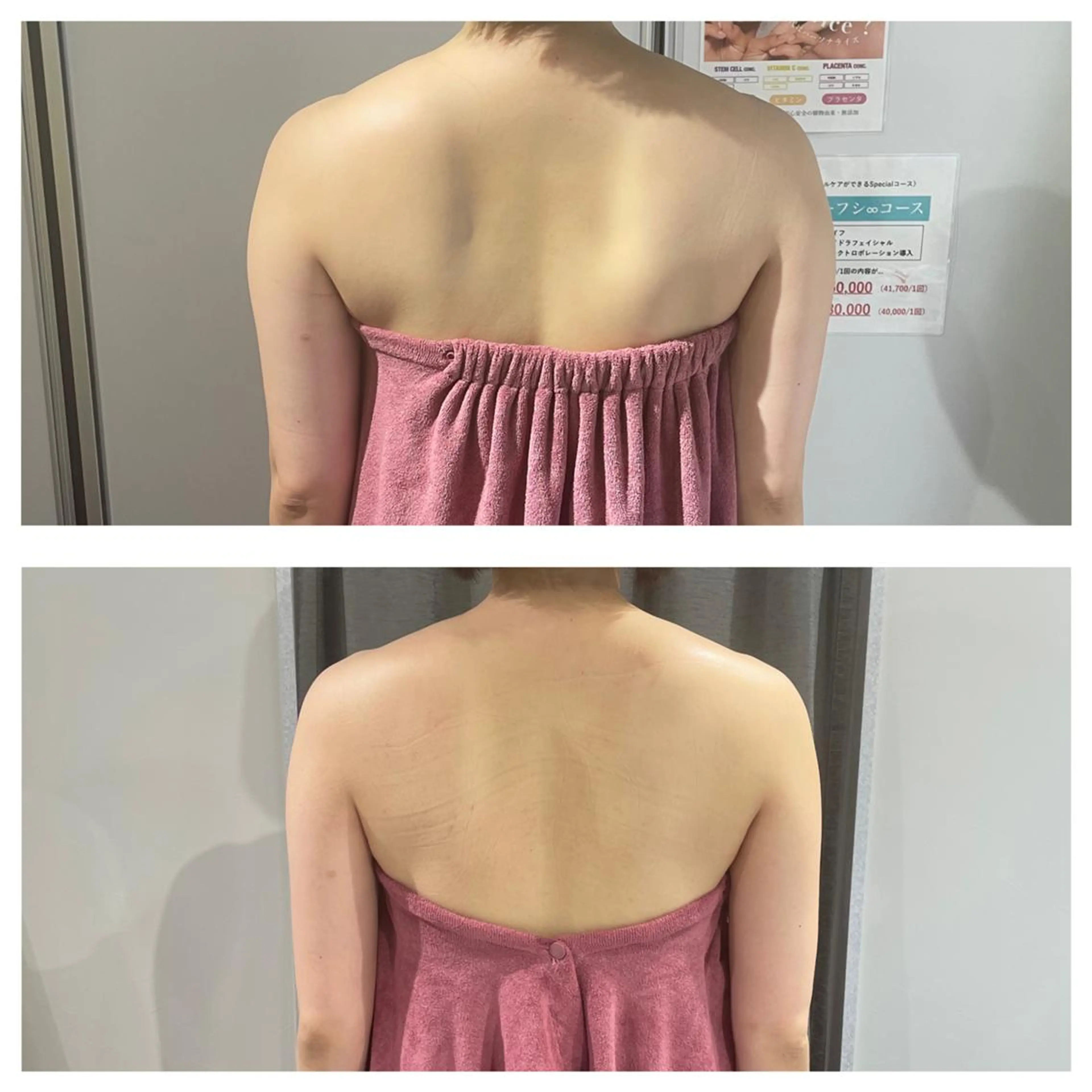 エステ リラク 部分痩せ♥️小顔専門 MIKUのエステ・リラクイメージ