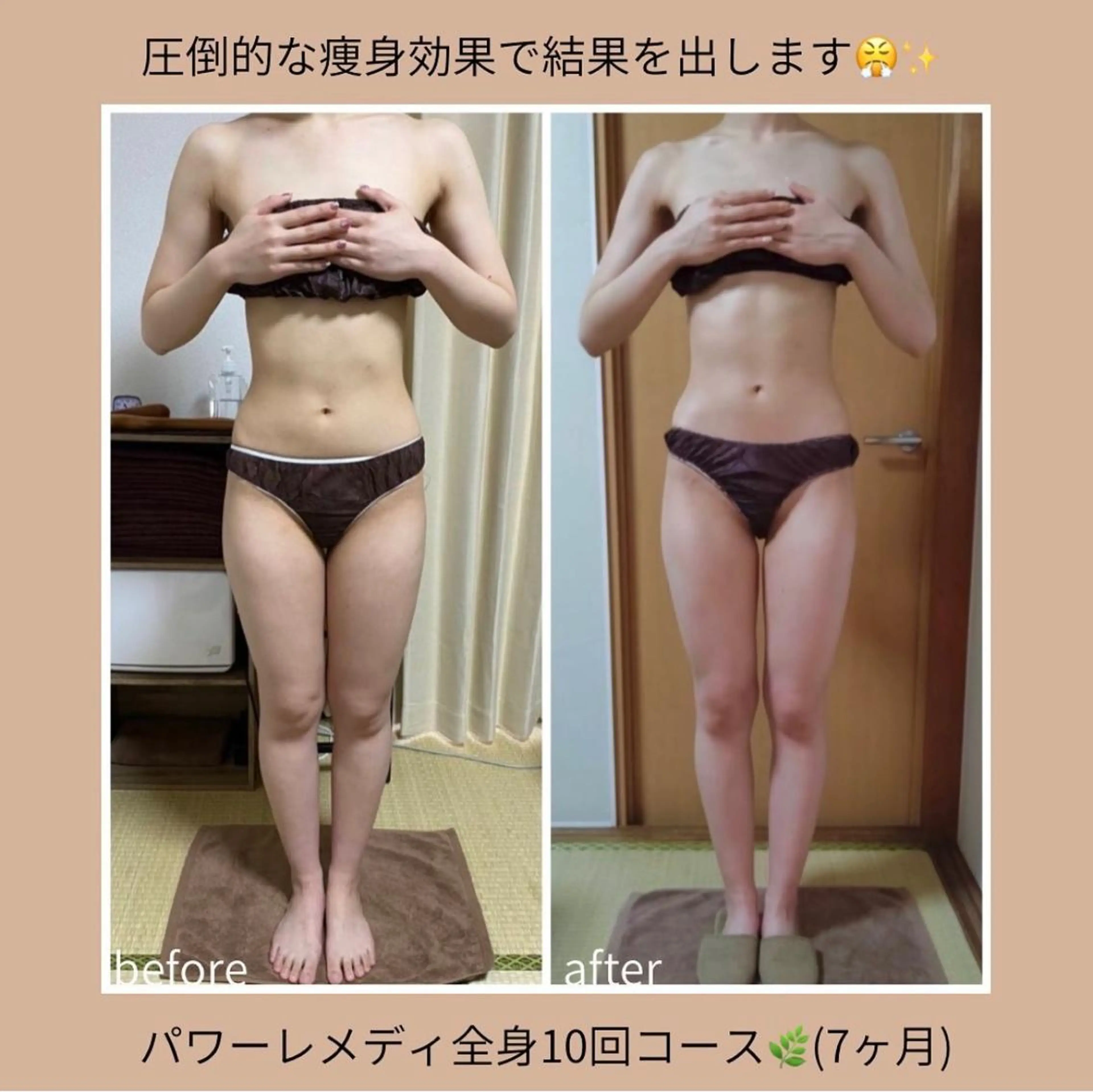 biloop所属・《本気痩せ×疲労改善 》  BILOOPのエステ・リラクイメージ