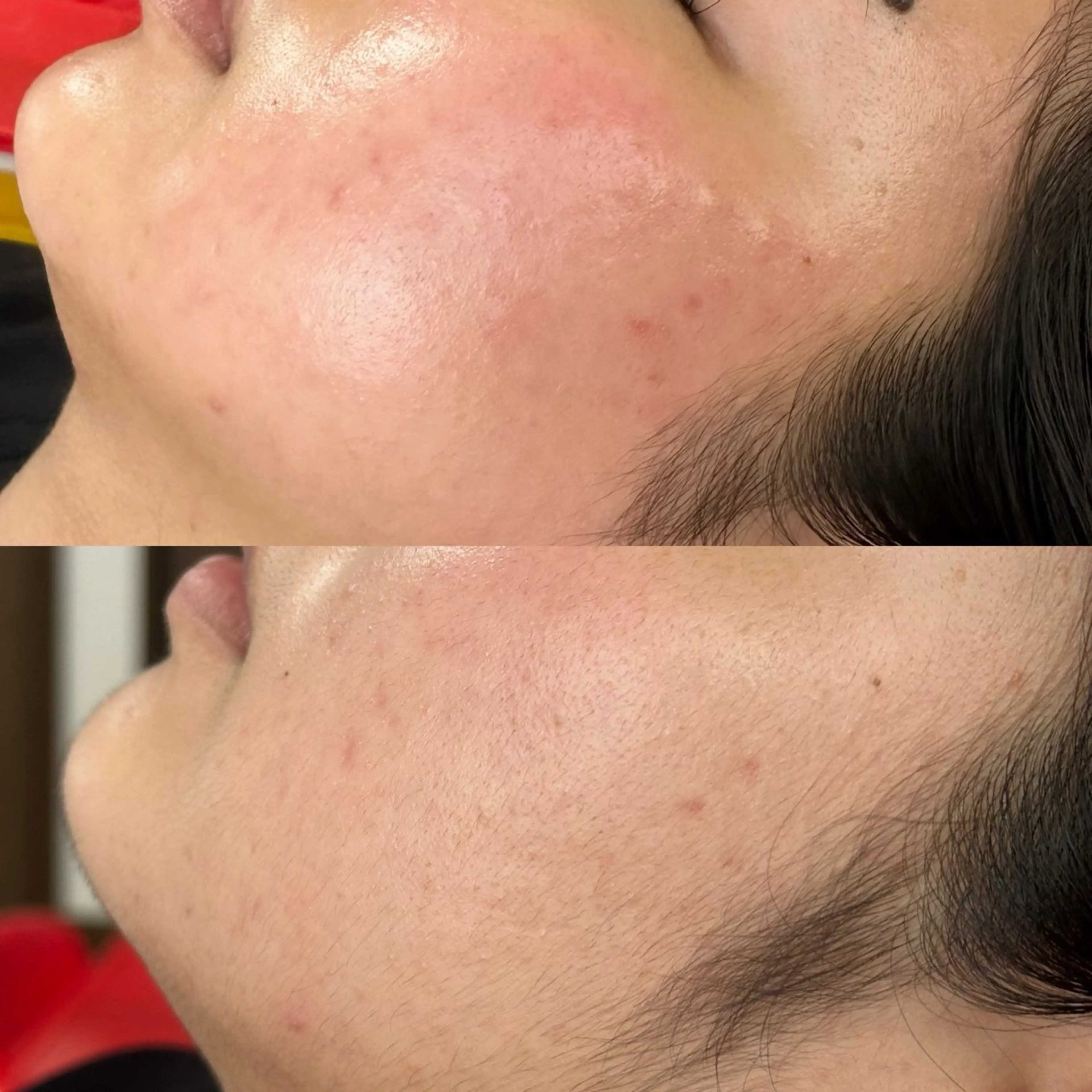 FACE WAX★全顔の写真