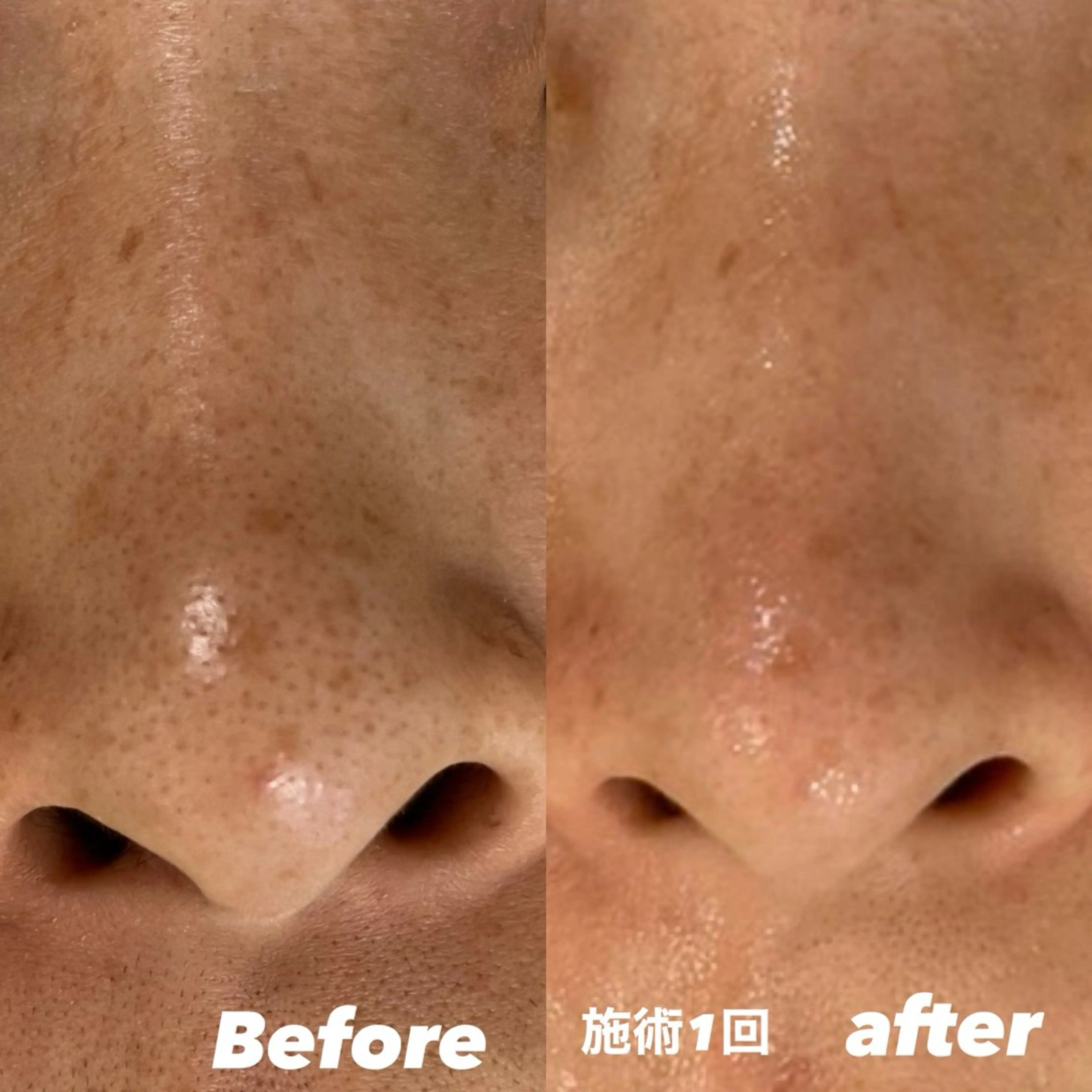 エステ 豊田 明里のエステ・リラクイメージ