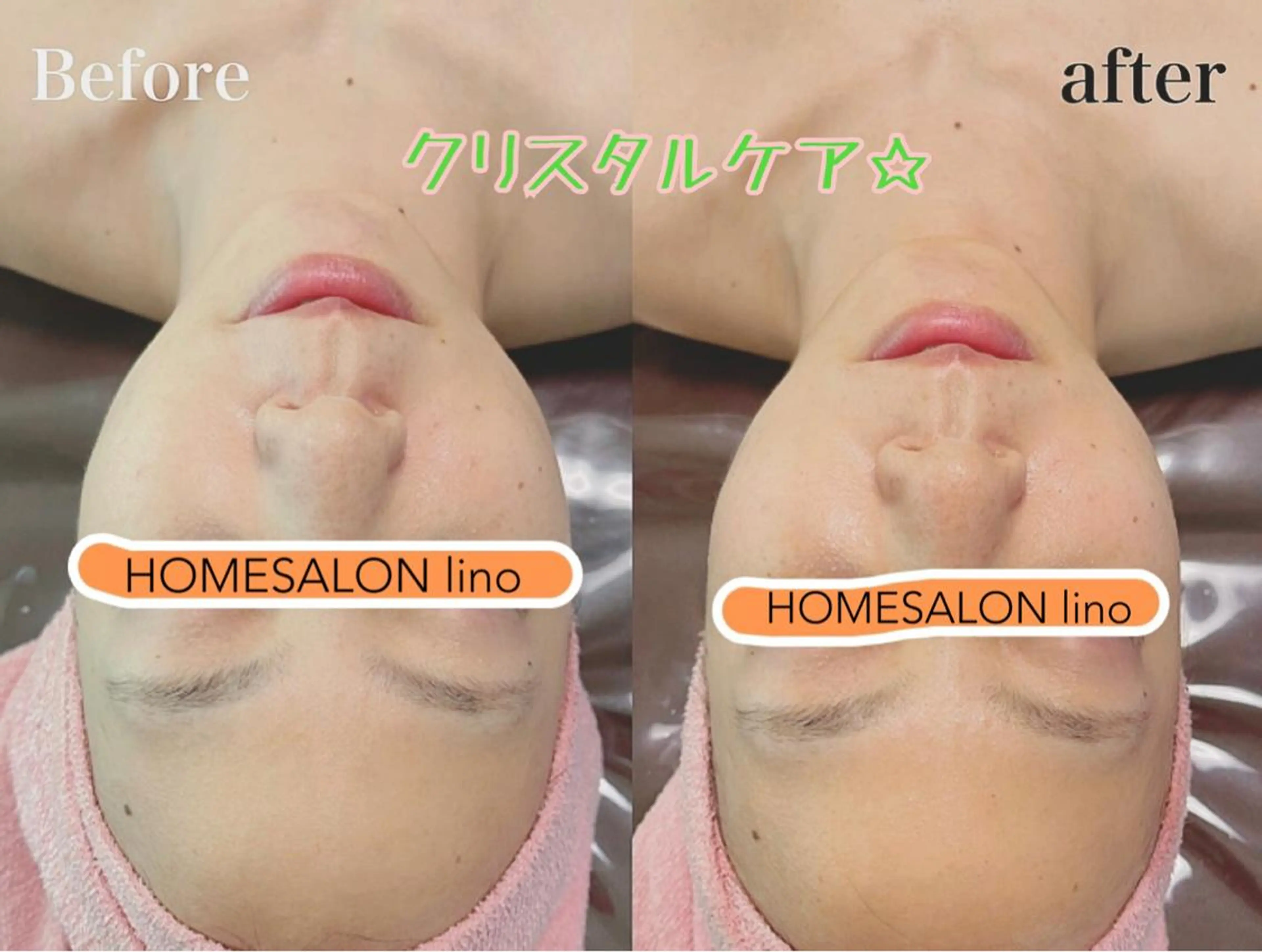 エステ HOME SALON linoのエステ・リラクイメージ