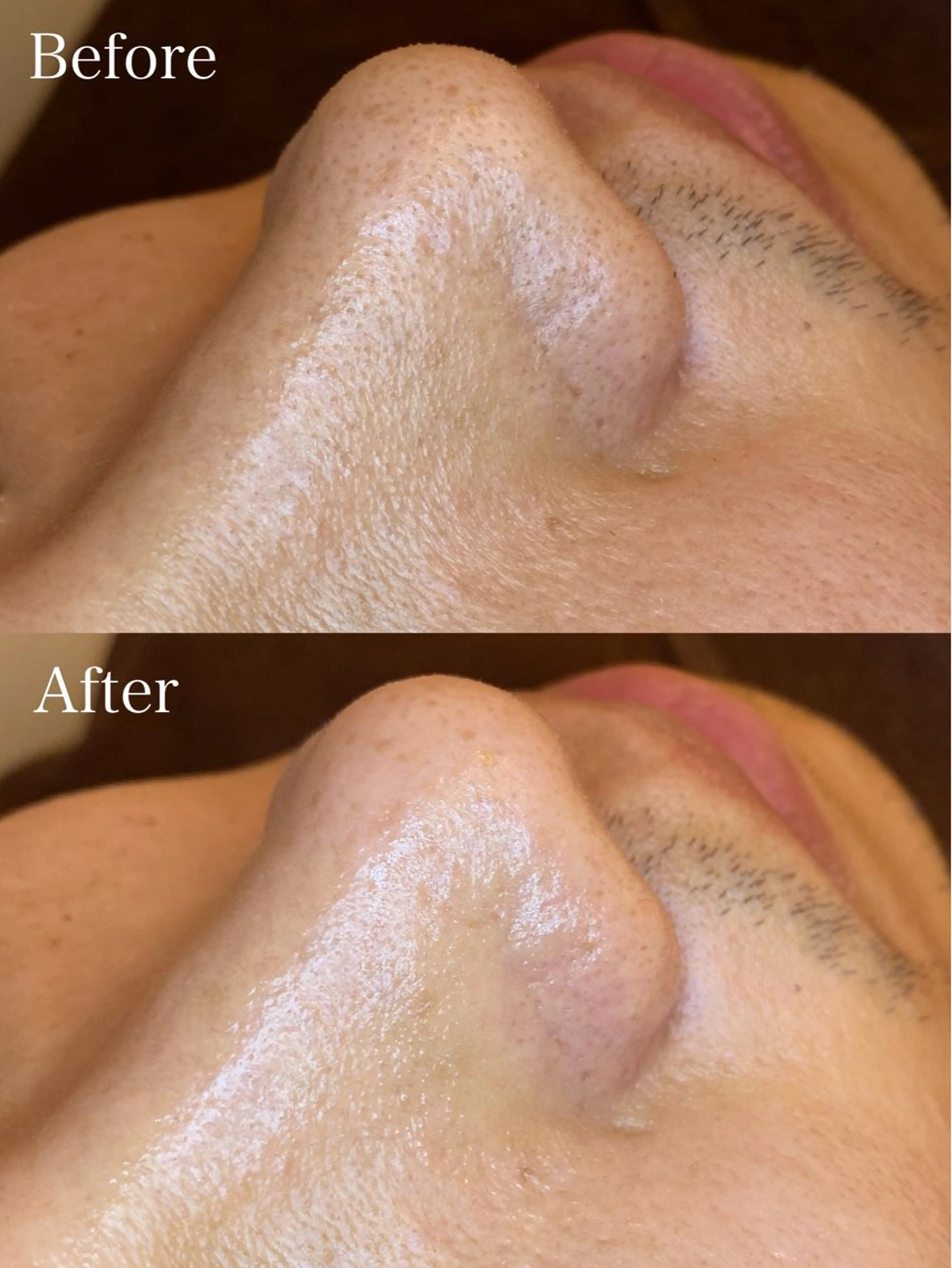 メンズ エステ EARTH coiffure beaute 新潟紫竹山店所属・🤍アベシュリ /フェイシャル🤍のエステ・リラクイメージ