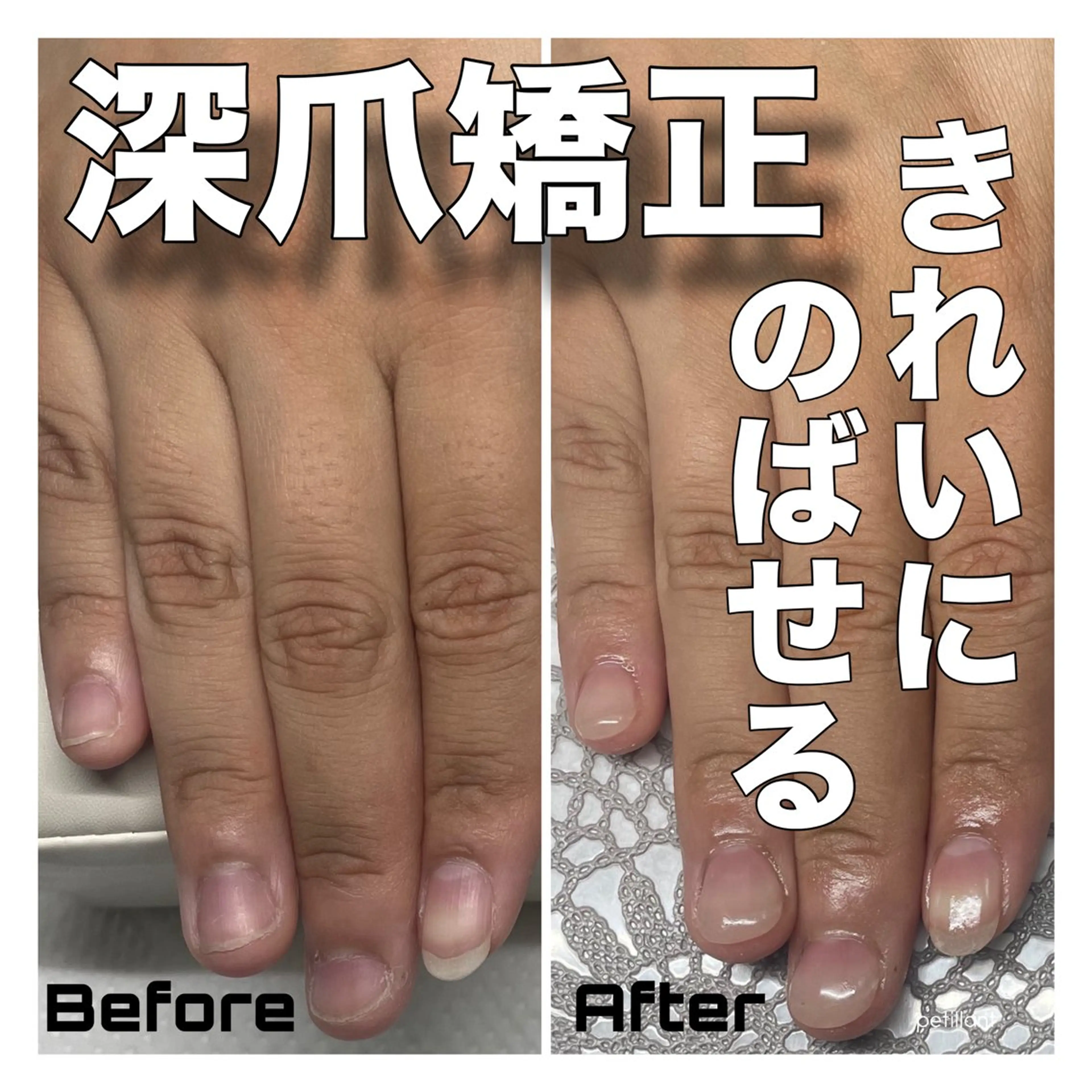 ネイル 長さ出し ハンドネイル ハンドケア petillant所属・nail salon petillantのネイルデザイン