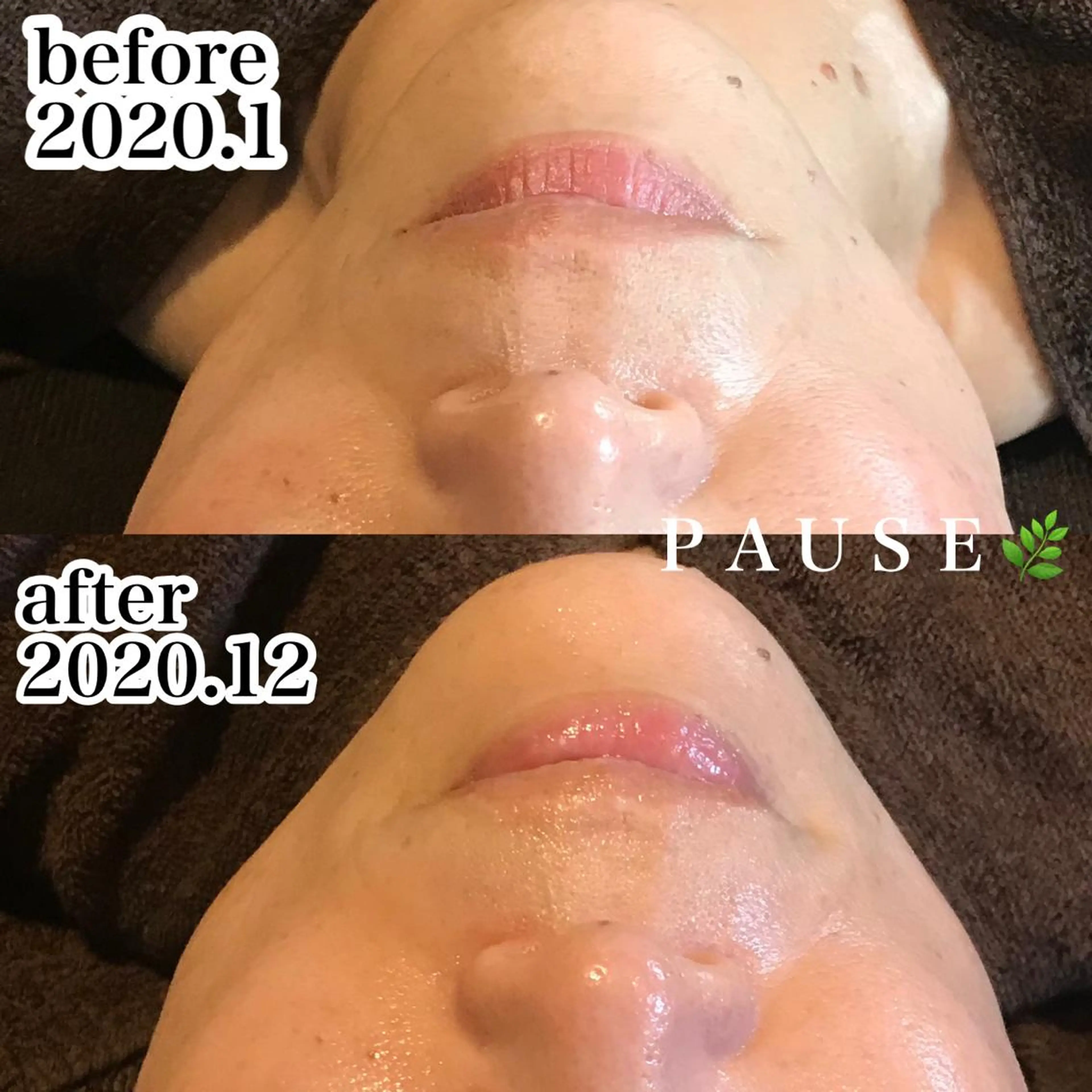 エステ 浜野 恵美のエステ・リラクイメージ