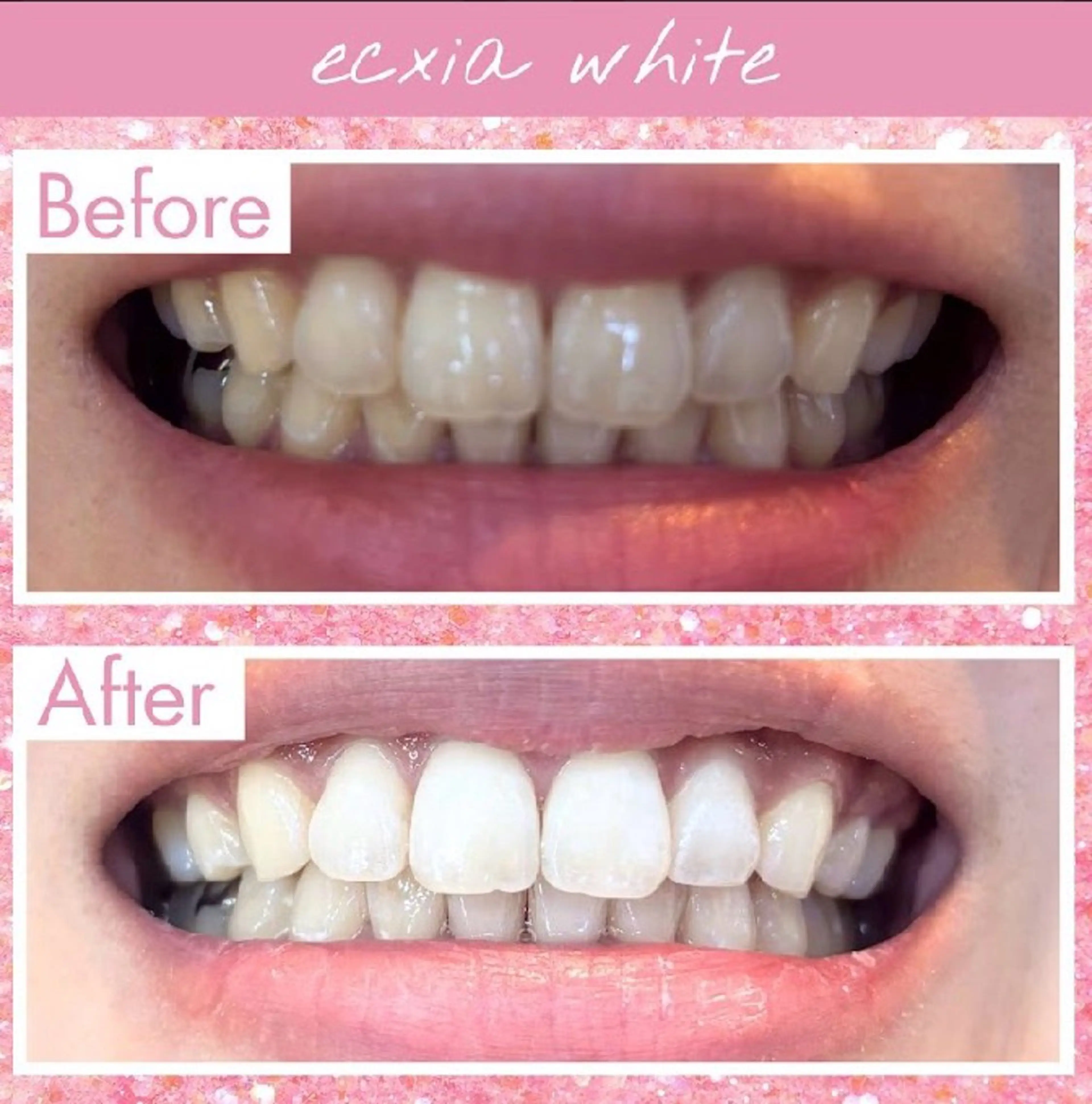 セルフホワイトニングサロンエクシアホワイト倉敷店所属・ecxiawhite 倉敷店のエステ・リラクイメージ