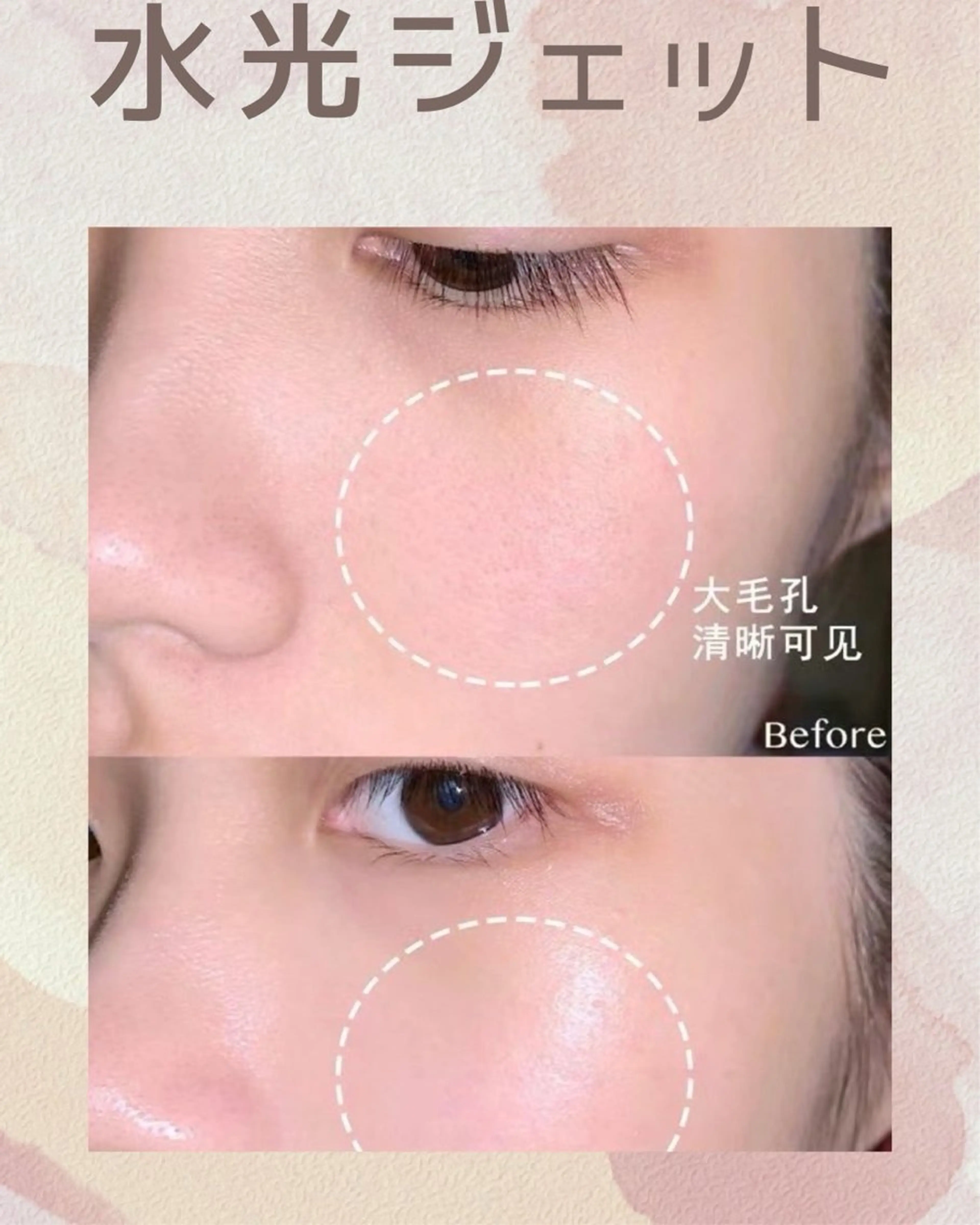 マツエク・マツパ エステ aliaハイフ&水光ジェットサロン所属・aliaハーブ水光店 エステティシャン募集のエステ・リラクイメージ