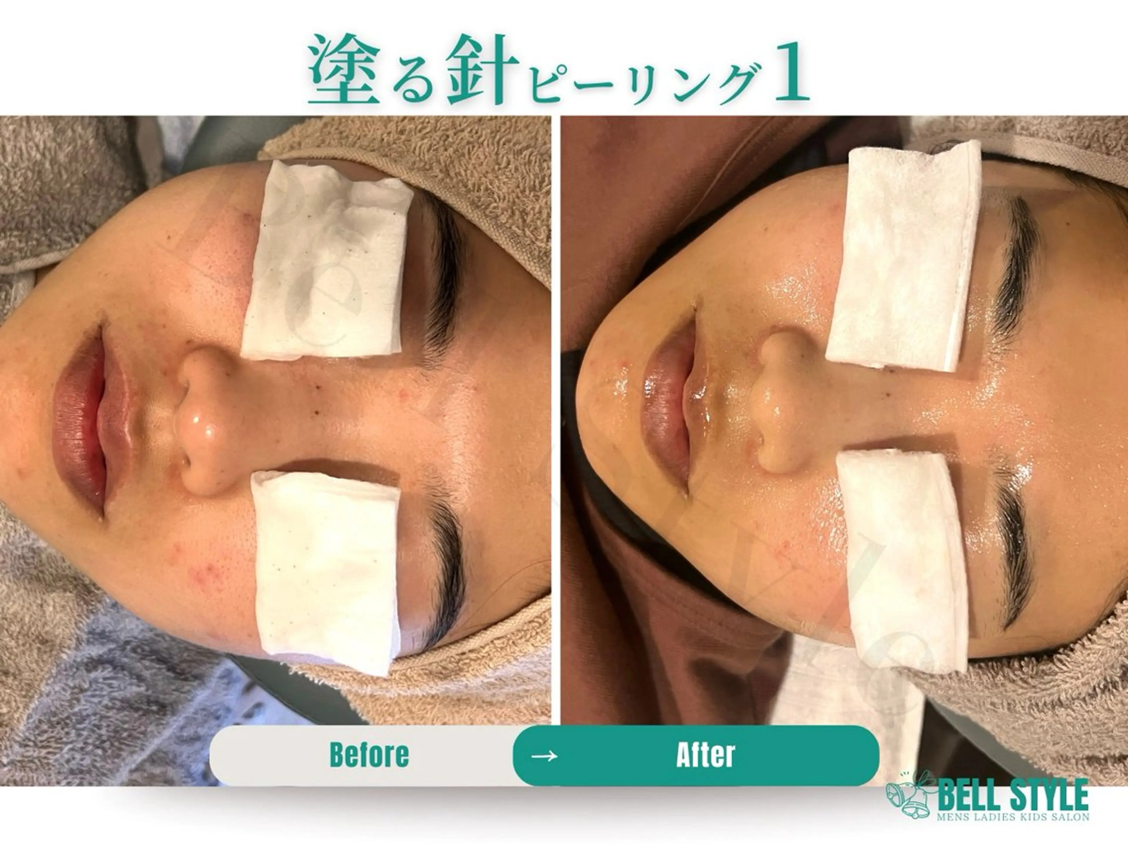 【脱毛・美肌専門】メンズ&レディースサロンBell style所属・【脱毛・美肌専門】 bellstyleのエステ・リラクイメージ