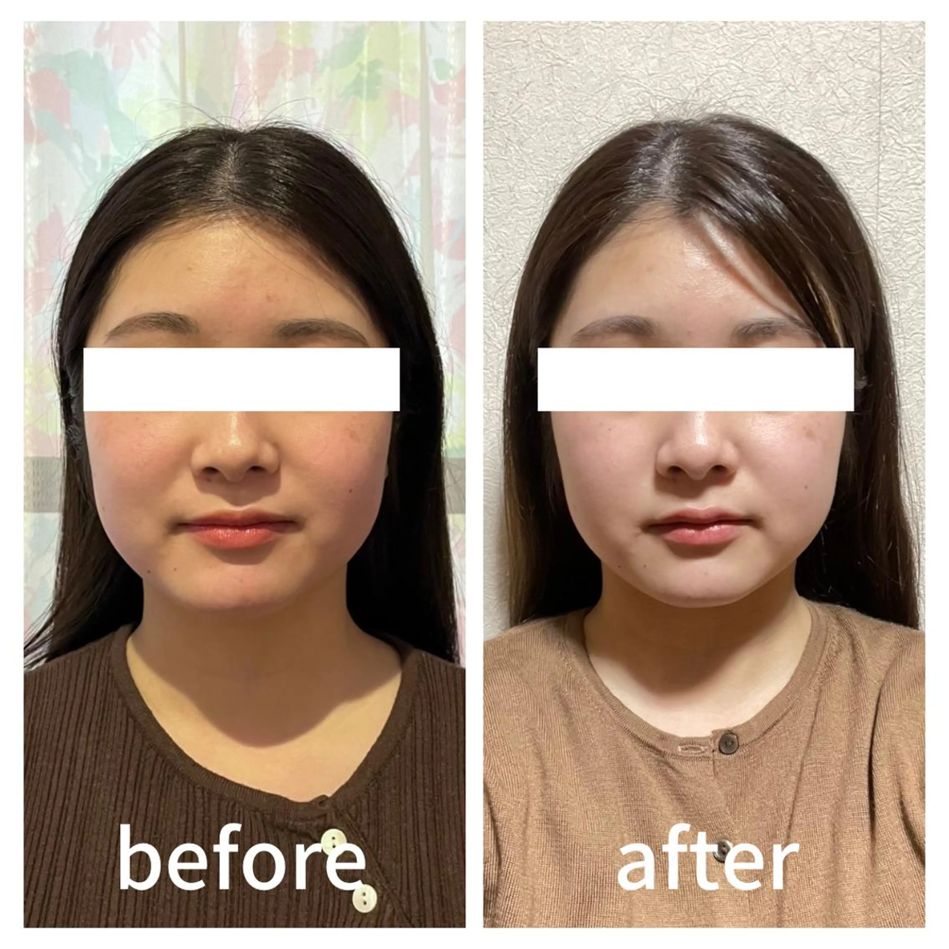 小顔サロン AMYONのエステ・リラクイメージ