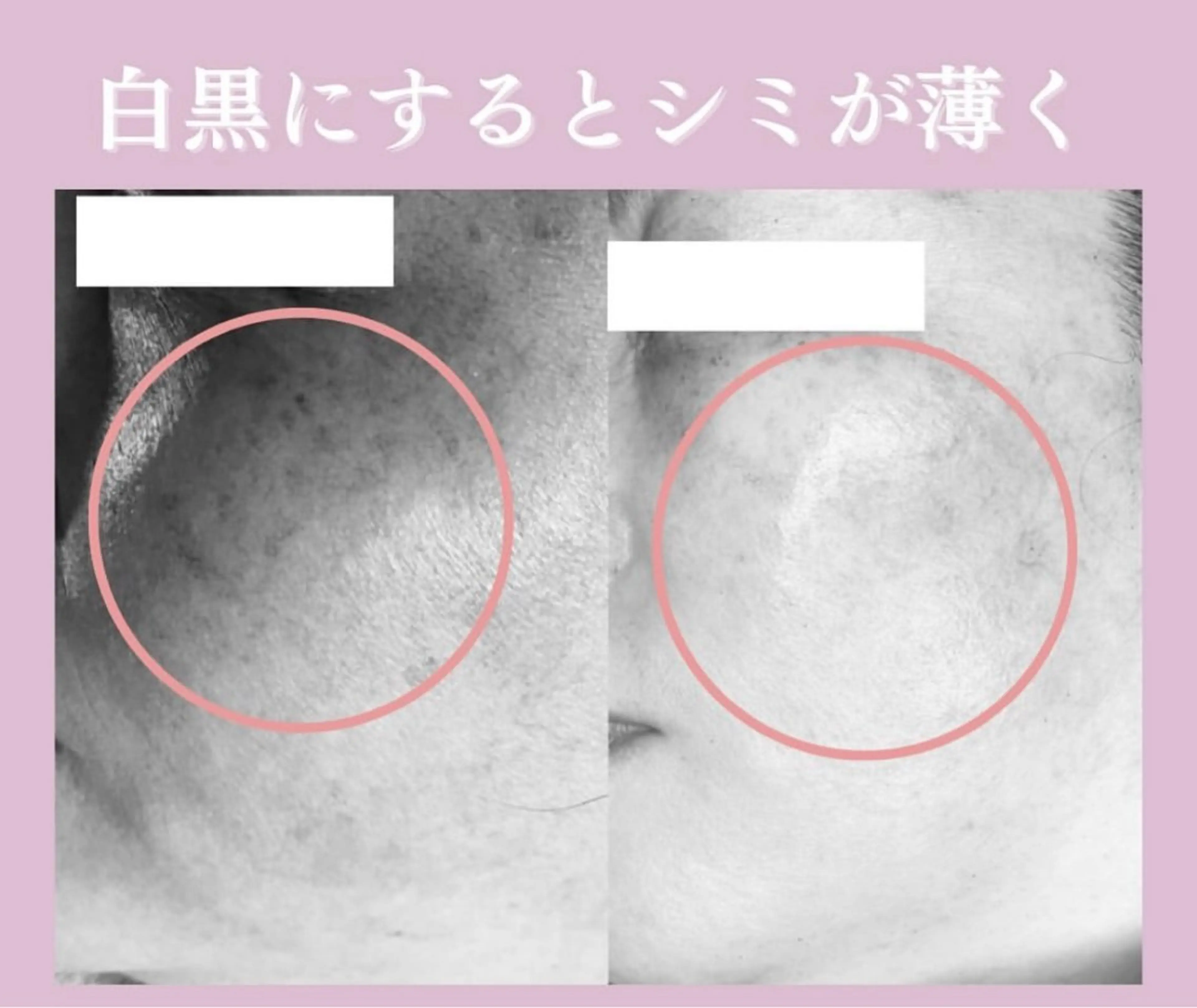 🦋肌改善 laule'a🦋のエステ・リラクイメージ