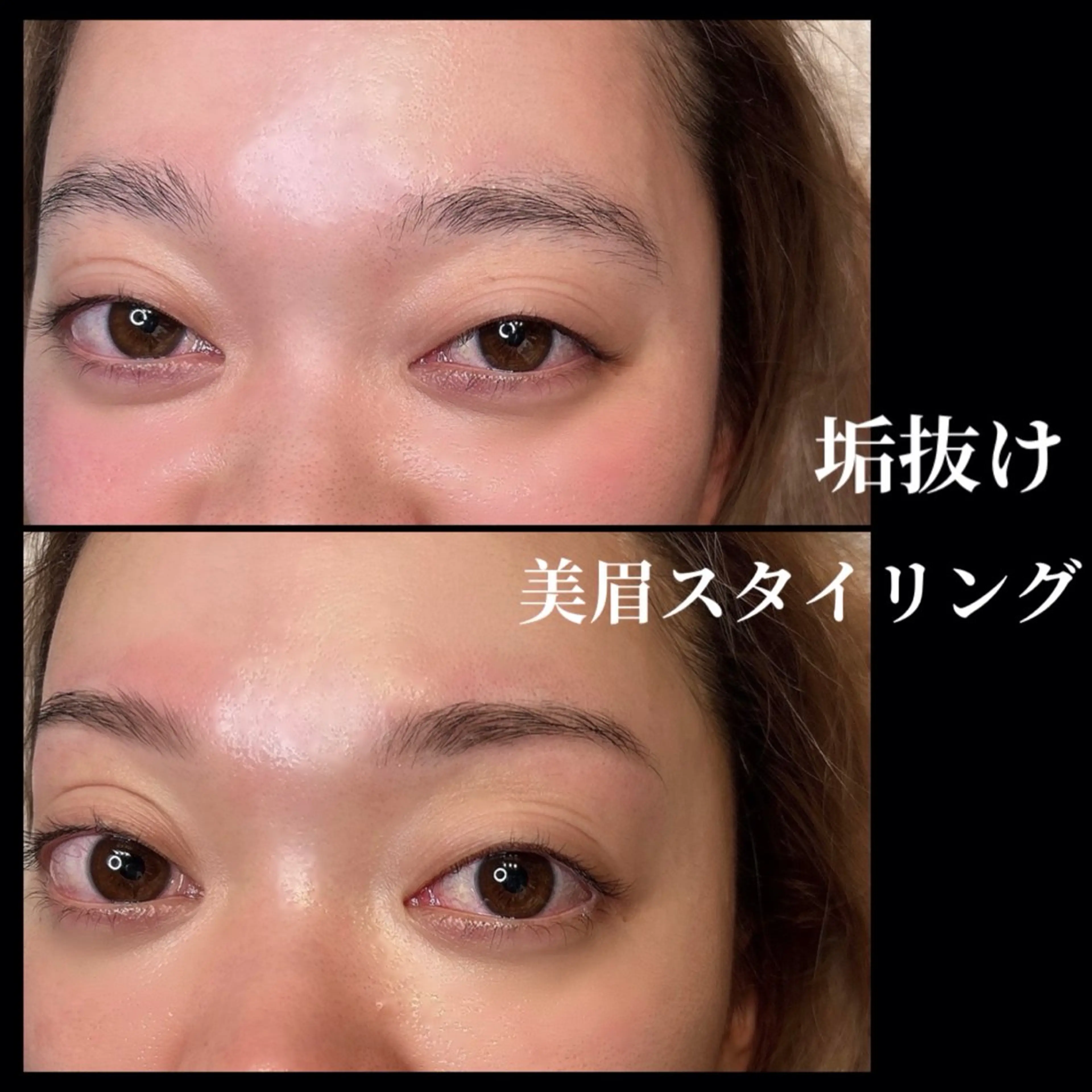 骨格似合わせ美眉WAX＋おでこWAXの写真