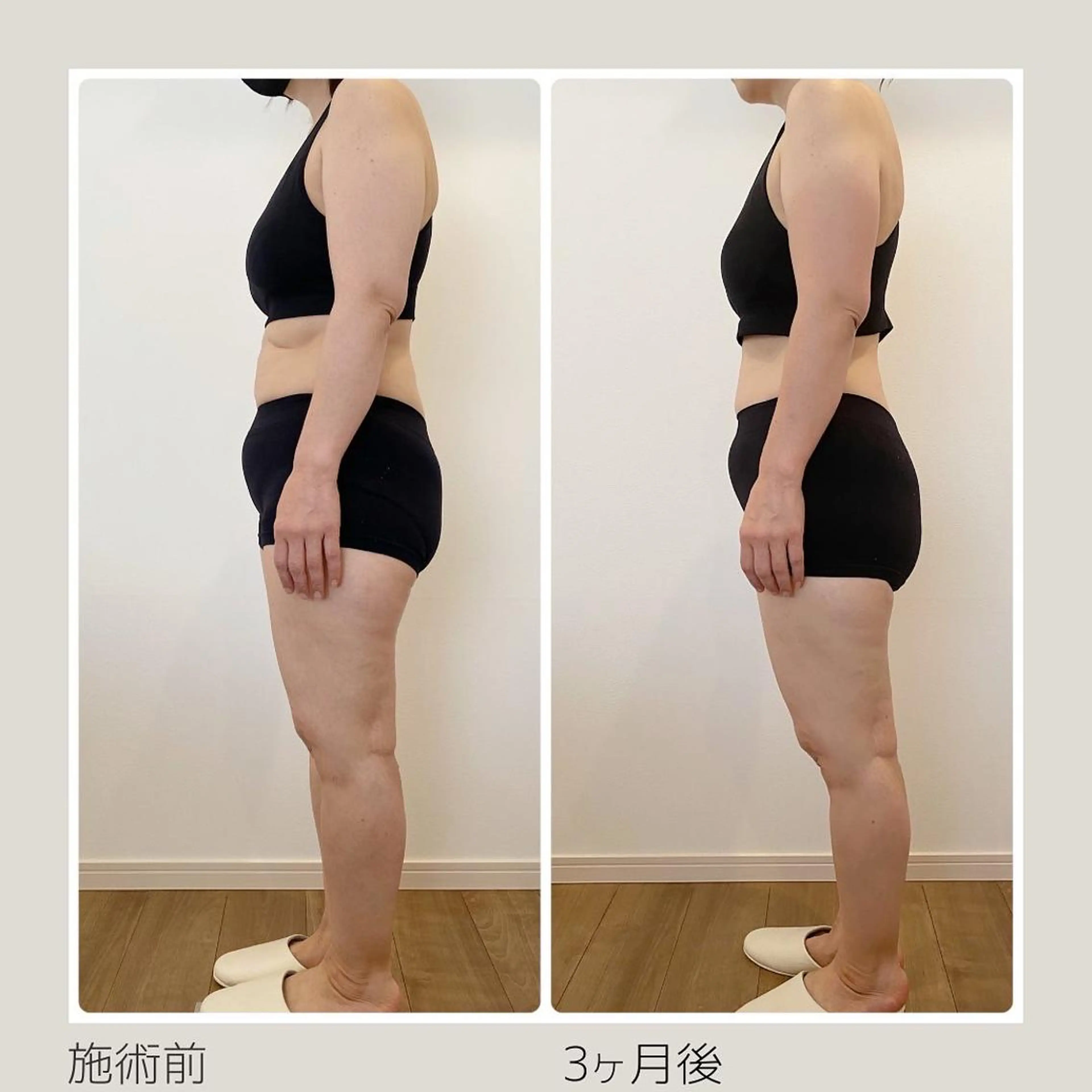 痩身＆ヘッド 長倉絵美のエステ・リラクイメージ