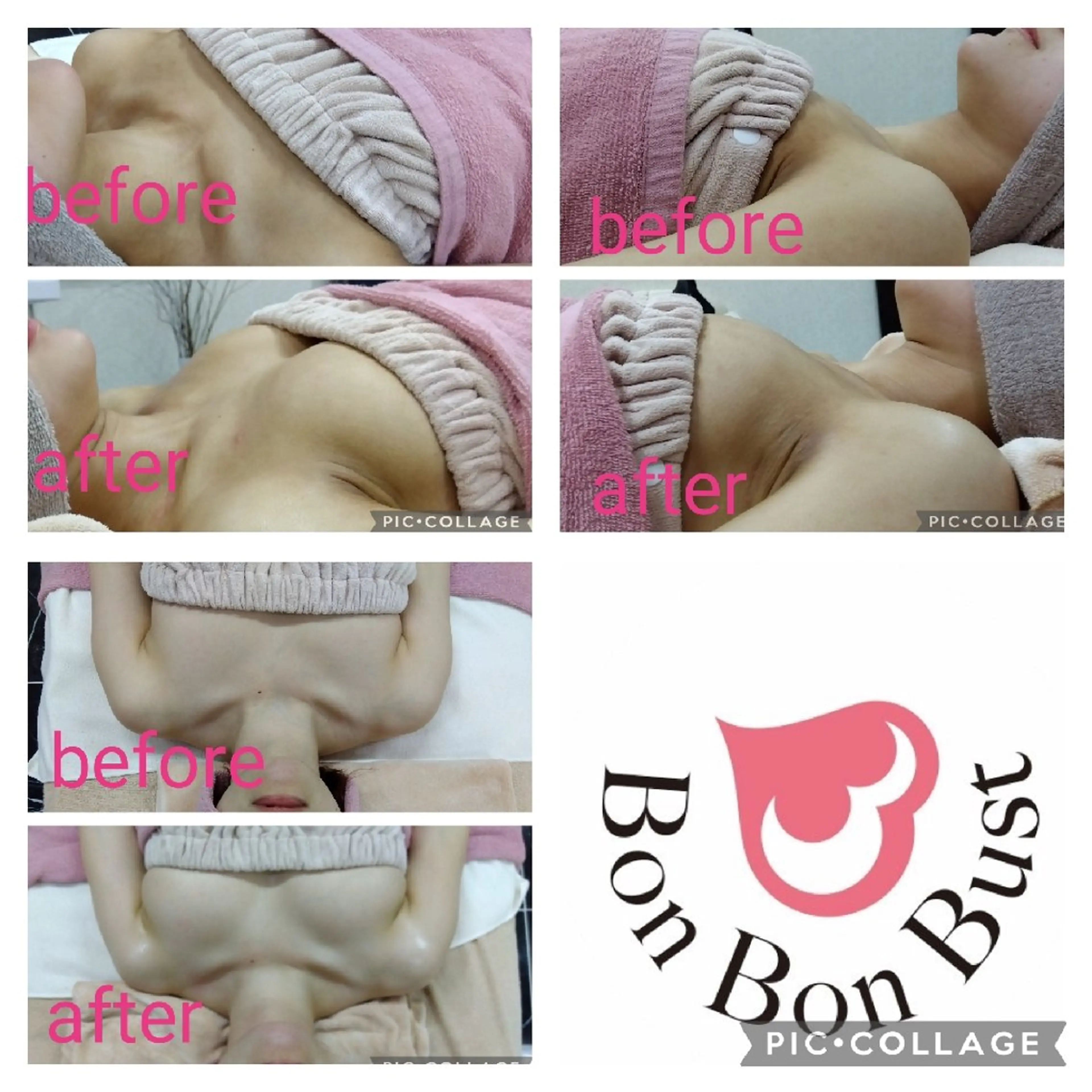 【minimo限定】バストアップ 元理学療法士＆看護師考案【人気No.1施術】90分ポレーション付き 初回￥15,000の写真