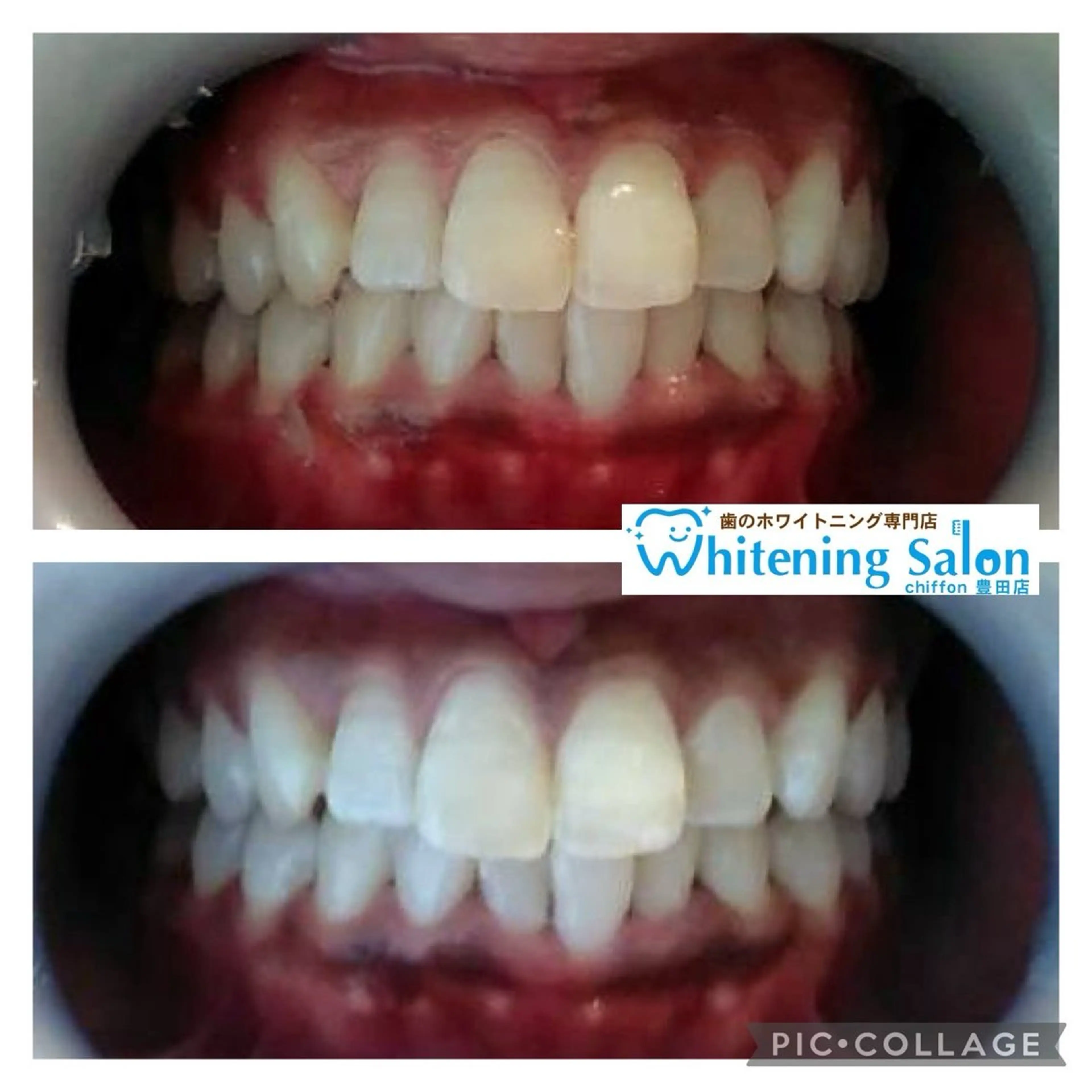 エステ ホワイトニングサロンシフォン豊田店所属・ホワイトニングサロン シフォン豊田店のその他イメージ