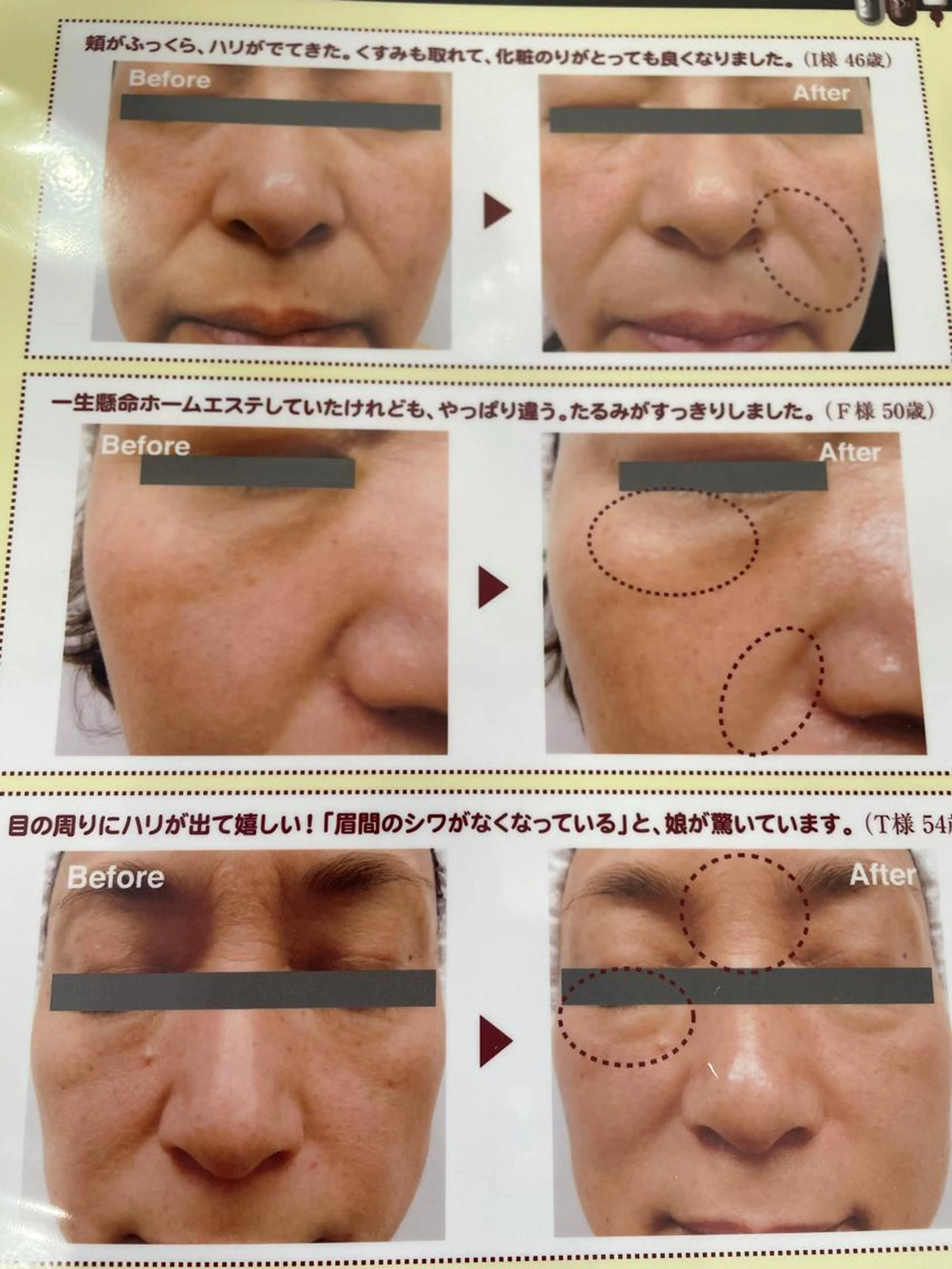 ダイレクトパフォーマンスの写真