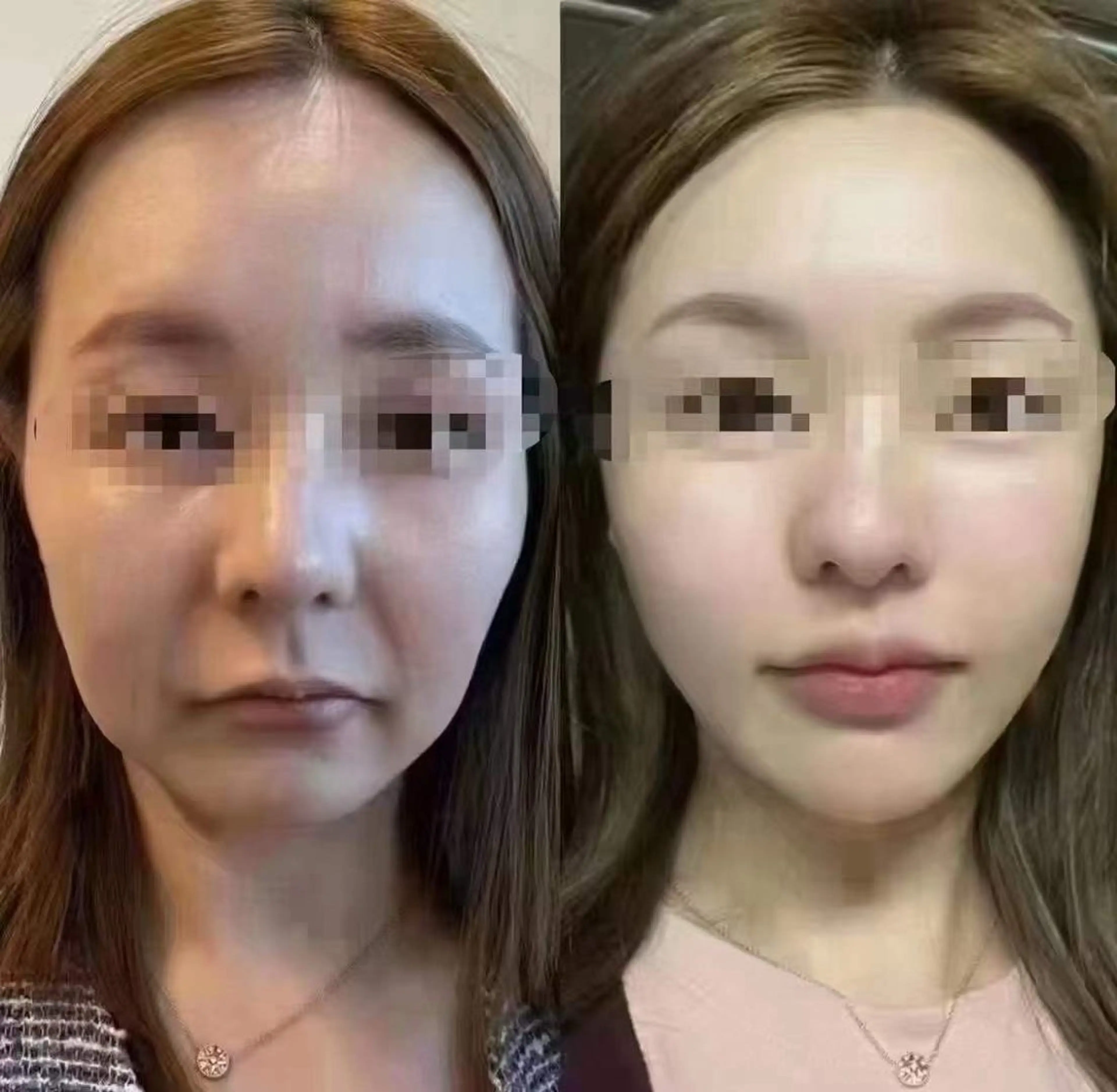 マツエク・マツパ エステ aliaハイフ&水光ジェットサロン所属・aliaハーブ水光店 エステティシャン募集のエステ・リラクイメージ